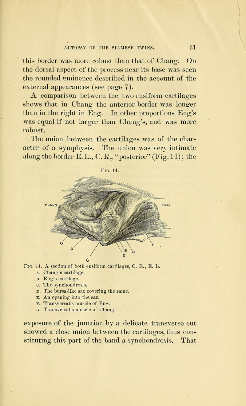 this border was more robust than that of Chang. On the dorsal aspect of the process near its base was seen the rounded eminence described in the account of the external appearances (see page 7). A comparison between the two ensiform cartilages shows that in Chang the anterior border was longer than in the right in Eng. In other proportions Eng's was equal if not larger than Chang's, and was more robust. The union between the cartilages was of the char- acter of a symphysis. The union was very intimate along the border E. L., C. E., posterior (Fig. 14); the Fig. 14. / C Fig. 14. A section of both ensiform cartilages, C. R., E. L. A. Chang's cartilage, B. Eng's cartilage. c. The synchondrosis. D. The bursa-like sac covering the same. E. An opening into the sac. F. Transversalis muscle of Eng. G. Transversalis muscle of Chang. exposure of the junction by a delicate transverse cut showed a close union between the cartilages, thus con- stituting this part of the band a synchondrosis. That