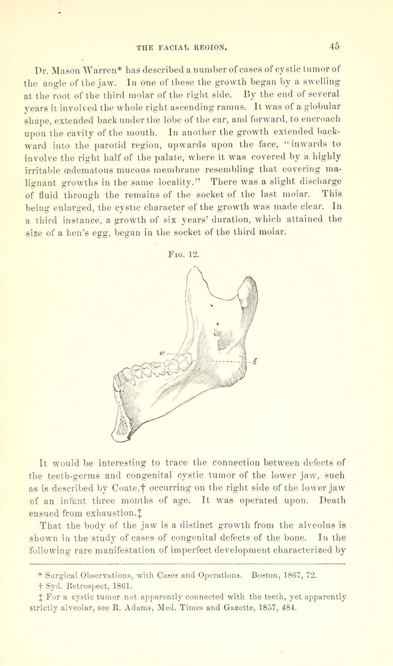 Pr. Mason Warren* has described a number of cases of cystic tumor of the angle of the jaw. In one of these the growth began by a swelling at the root of the third molar of the right side. By the end of several years it involved the whole right ascending ramus. It was of a globular shape, extended back under the lobe of the ear, and forward, to encroach upon the cavity of the mouth. In another the growth extended back- ward into the parotid region, upwards upon the face, inwards to involve the right half of the palate, where it was covered by a highly irritable oedematous mucous membrane resembling that covering ma- lignant growths in the same locality. There was a slight discharge of fluid through the remains of the socket of the last molar. This being enlarged, the cystic character of the growth was made clear. In a third instance, a growth of six years' duration, which attained the size of a hen's egg, began in the socket of the third molar. Fig. 12. It would be interesting to trace the connection between defects of the teeth-germs and congenital cystic tumor of the lower jaw, such as is described by Coate,t occurring on the right side of the lower jaw of an infant three months of age. It was operated upon. Death ensued from exhaustion.| That the body of the jaw is a distinct growth from the alveolus is shown in the study of cases of congenital defects of the bone. In the following rare manifestation of imperfect development characterized by * Surgical Observations, with Cases and Operations. Boston, 1867, 72. f Syd. Ketrospect, 1861. J For a cystic tumor not apparently connected with the teeth, yet apparently strictly alveolar, see K. Adams, Med. Times and Gazette, 1857, 484.