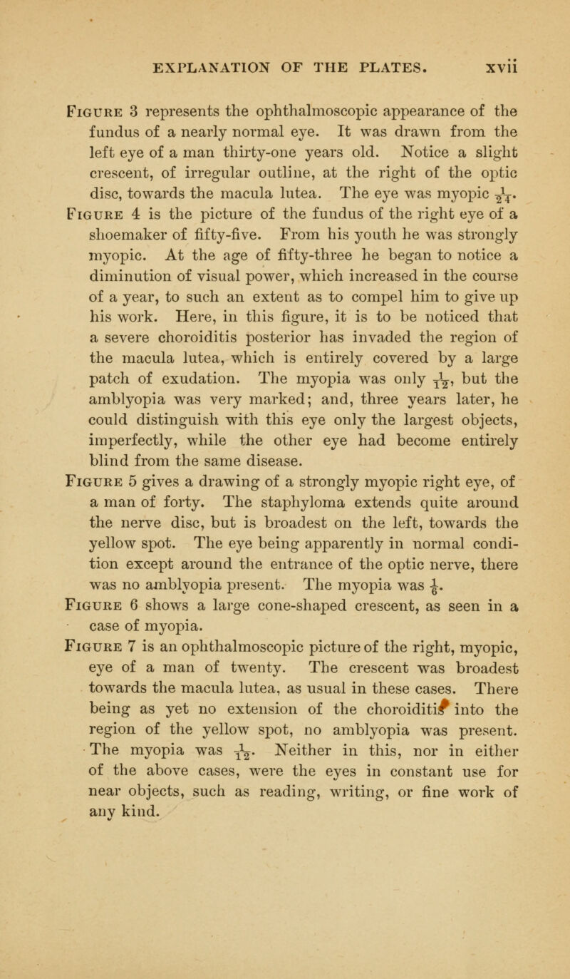 Figure 3 represents the ophthalmoscopic appearance of the fundus of a nearly normal eye. It was drawn from the left eye of a man thirty-one years old. Notice a slight crescent, of irregular outline, at the right of the optic disc, towards the macula lutea. The eye was myopic gV Figure 4 is the picture of the fundus of the right eye of a shoemaker of fifty-five. From his youth he was strongly myopic. At the age of fifty-three he began to notice a diminution of visual power, which increased in the course of a year, to such an extent as to compel him to give up his work. Here, in this figure, it is to be noticed that a severe choroiditis posterior has invaded the region of the macula lutea, which is entirely covered by a large patch of exudation. The myopia was only ^ but the amblyopia was very marked; and, three years later, he could distinguish with this eye only the largest objects, imperfectly, while the other eye had become entirely blind from the same disease. Figure 5 gives a drawing of a strongly myopic right eye, of a man of forty. The staphyloma extends quite around the nerve disc, but is broadest on the left, towards the yellow spot. The eye being apparently in normal condi- tion except around the entrance of the optic nerve, there was no amblyopia present. The myopia was \. Figure 6 shows a large cone-shaped crescent, as seen in a case of myopia. Figure 7 is an ophthalmoscopic picture of the right, myopic, eye of a man of twenty. The crescent was broadest towards the macula lutea, as usual in these cases. There being as yet no extension of the choroiditis into the region of the yellow spot, no amblyopia was present. The myopia was ^. Neither in this, nor in either of the above cases, were the eyes in constant use for near objects, such as reading, writing, or fine work of anv kind.