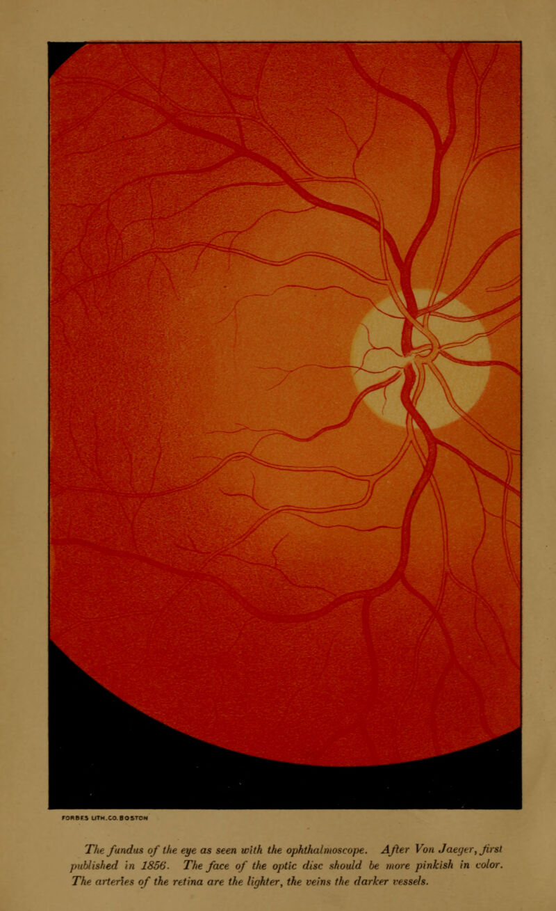 F0RBF5 LlTM.CO BOSTON The fundus of the eye as seen with the ophthalmoscope. After Von J'aeyer, Jirsl published in 1856. The face of the optic disc should be more pinkish in color. The arteries of the retina are the lighter, the veins the darker vessels.