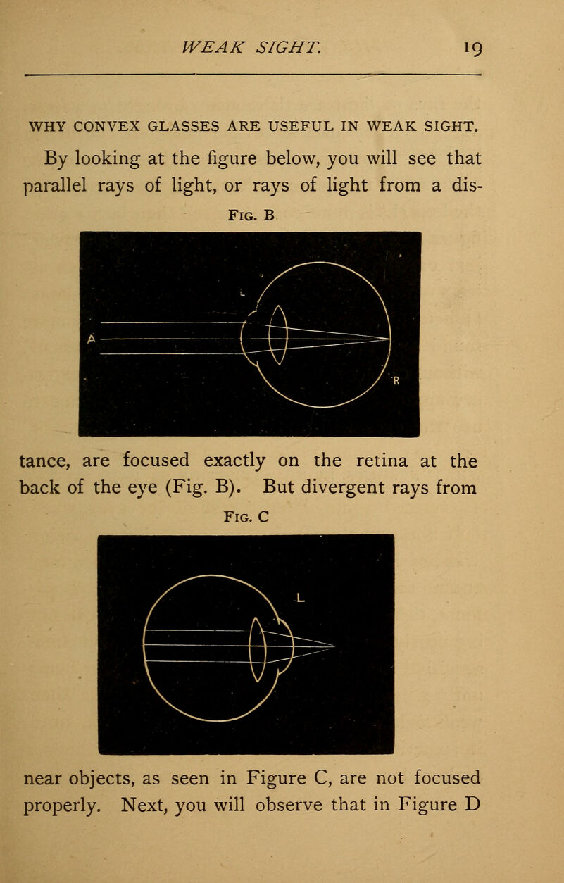 WHY CONVEX GLASSES ARE USEFUL IN WEAK SIGHT. By looking at the figure below, you will see that parallel rays of light, or rays of light from a dis- Fig. B tance, are focused exactly on the retina at the back of the eye (Fig. B). But divergent rays from Fig. C near objects, as seen in Figure C, are not focused properly. Next, you will observe that in Figure D