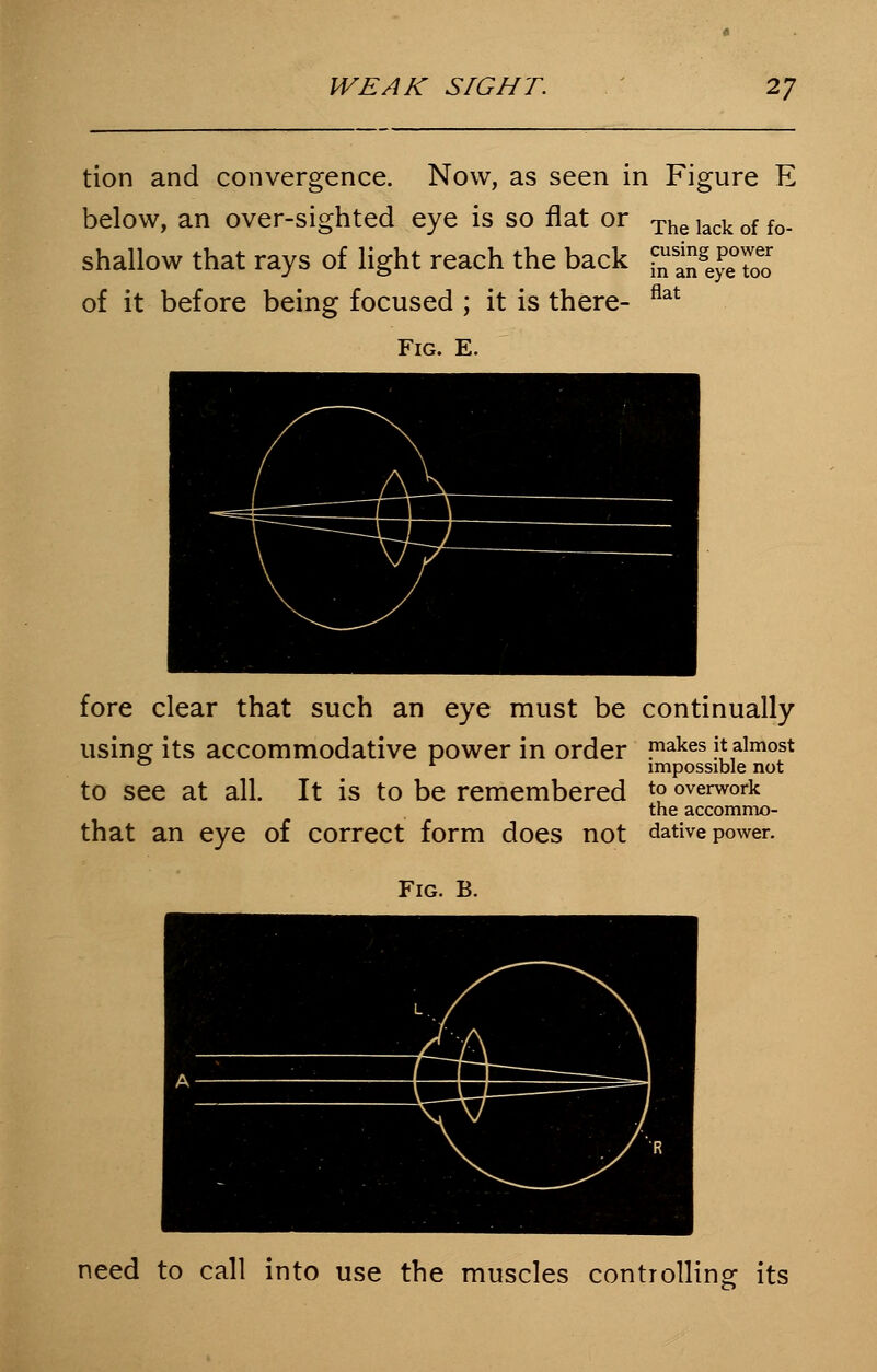 tion and convergence. Now, as seen in Figure E below, an over-sighted eye is so flat or The lack of fo_ shallow that rays of light reach the back S^ge£S!; of it before being focused ; it is there- flat Fig. E. fore clear that such an eye must be continually using its accommodative power in order makes jt almost 1 impossible not to see at all. It is to be remembered to overwork the accommo- that an eye of correct form does not dative power. Fig. B. need to call into use the muscles controlling its