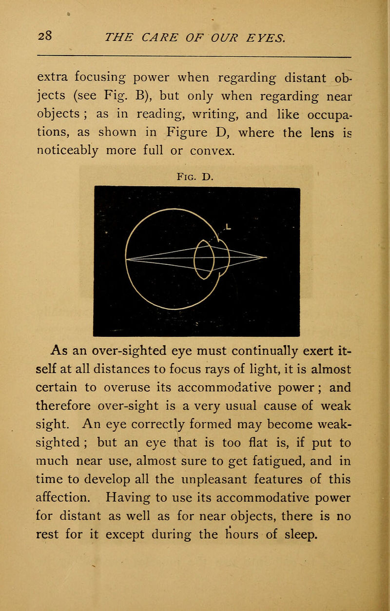 extra focusing power when regarding distant ob- jects (see Fig. B), but only when regarding near objects ; as in reading, writing, and like occupa- tions, as shown in Figure D, where the lens is noticeably more full or convex. Fig. D. As an over-sighted eye must continually exert it- self at all distances to focus rays of light, it is almost certain to overuse its accommodative power; and therefore over-sight is a very usual cause of weak sight. An eye correctly formed may become weak- sighted ; but an eye that is too flat is, if put to much near use, almost sure to get fatigued, and in time to develop all the unpleasant features of this affection. Having to use its accommodative power for distant as well as for near objects, there is no rest for it except during the hours of sleep.
