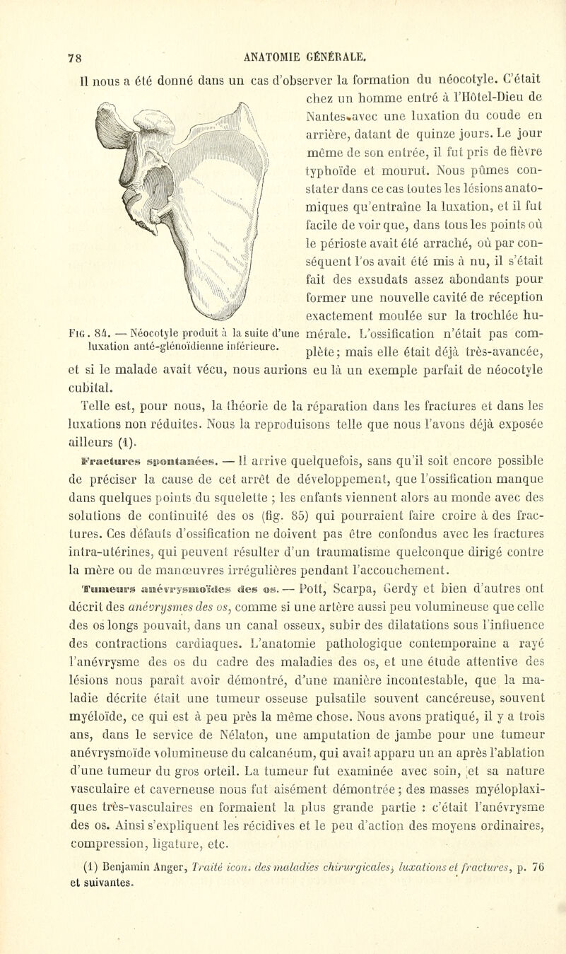 Il nous a été donné dans un cas d'observer la formation du néocotyle. C'était chez un homme entré à l'Hôtel-Dieu de Nantes»avec une luxation du coude en arrière, datant de quinze jours. Le jour même de son entrée, il fut pris de fièvre typhoïde et mourut. Nous pûmes con- stater dans ce cas toutes les lésions anato- miques qu'entraîne la luxation, et il fut facile de voir que, dans tous les points où le périoste avait été arraché, où par con- séquent l'os avait été mis à nu, il s'était fait des exsudais assez abondants pour former une nouvelle cavité de réception exactement moulée sur la trochlée hu- FiG. 8à. — Néocotj'le produit à la suite d'une mérale. L'ossification n'était pas com- luxation anté-glénoïdienne inférieure. p^^^e; mais elle était déjà très-avancée, et si le malade avait vécu, nous aurions eu là un exemple parfait de néocotyle cubital. Telle est, pour nous, la théorie de la réparation dans les fractures et dans les luxations non réduites. Nous la reproduisons telle que nous l'avons déjà exposée ailleurs (1). Fractiires ssientaiiées. — Il arrive quelquefois, sans qu'il soit encore possible de préciser la cause de cet arrêt de développement, que l'ossification manque dans quelques points du squelette ; les enfants viennent alors au monde avec des solutions de continuité des os (fig. 85) qui pourraient faire croire à des frac- tures. Ces défauts d'ossification ne doivent pas être confondus avec les fractures intra-utérines, qui peuvent résulter d'un traumatisme quelconque dirigé contre la mère ou de manœuvres irrégulières pendant l'accouchement. TiuneBirs amévi'yssmo'Mes des ®s. — Pott, Scarpa, Gerdy et bien d'autres ont décrit des anévrysmes des os, comme si une artère aussi peu volumineuse que celle des os longs pouvait, dans un canal osseux, subir des dilatations sous l'influence des contractions cardiaques. L'anatomie pathologique contemporaine a rayé l'anévrysme des os du cadre des maladies des os, et une étude attentive des lésions nous paraît avoir démontré, d'une manière incontestable, que la ma- ladie décrite était une tumeur osseuse pulsatile souvent cancéreuse, souvent myéloïde, ce qui est à peu près la môme chose. Nous avons pratiqué, il y a trois ans, dans le service de Nélaton, une amputation de jambe pour une tumeur anévrysmoïde volumineuse du calcanéum, qui avait apparu un an après l'ablation d'une tumeur du gros orteil. La tumeur fut examinée avec soin, et sa nature vasculaire et caverneuse nous fut aisément démontrée ; des masses myéloplaxi- ques très-vasculaires en formaient la plus grande partie : c'était l'anévrysme des os. Ainsi s'expliquent les récidives et le peu d'action des moyens ordinaires, compression, ligature, etc. (1) Benjamin Anger, Traité icon, des maladies chirurgicales, luxations et fractures, p. 76 et suivantes.