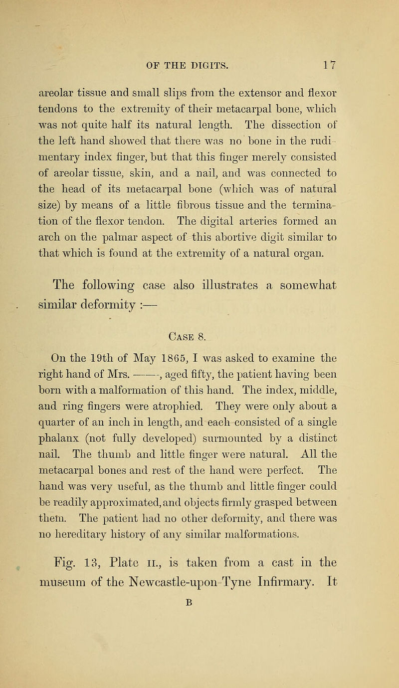 areolar tissue and small slips from the extensor and flexor tendons to the extremity of their metacarpal bone, which was not quite half its natural length. The dissection of the left hand showed that there was no bone in the rudi mentary index finger, but that this finger merely consisted of areolar tissue, skin, and a nail, and was connected to the head of its metacarpal bone (which was of natural size) by means of a little fibrous tissue and the termina- tion of the flexor tendon. The digital arteries formed an arch on the palmar aspect of this abortive digit similar to that which is found at the extremity of a natural organ. The following case also illustrates a somewhat similar deformity :— Case 8. On the 19th of May 1865, I was asked to examine the right hand of Mrs. , aged fifty, the patient having been born with a malformation of this hand. The index, middle, and ring fingers were atrophied. They were only about a quarter of an inch in length, and each consisted of a single phalanx (not fully developed) surmounted by a distinct nail. The thumb and little finger were natural. All the metacarpal bones and rest of the hand were perfect. The hand was very useful, as the thumb and little finger could be readily approximated, and objects firmly grasped between them. The patient had no other deformity, and there was no hereditary history of any similar malformations. Fig. 13, Plate il, is taken from a cast in the museum of the Newcastle-upon-Tyne Infirmary. It B