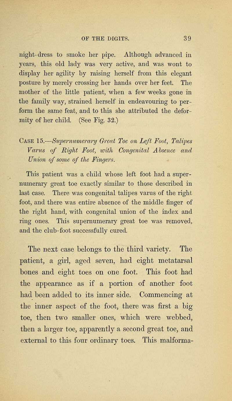 night-dress to smoke her pipe. Although advanced in years, this old lady was very active, and was wont to display her agility by raising herself from this elegant posture by merely crossing her hands over her feet. The mother of the little patient, when a few weeks gone in the family way, strained herself in endeavouring to per- form the same feat, and to this she attributed the defor- mity of her child. (See Fig. 32.) Case 15.—Supernumerary Great Toe on Left Foot, Talipes Varus of Right Foot, ivith Congenital Absence and Union of some of the Fingers. This patient was a child whose left foot had a super- numerary great toe exactly similar to those described in last case. There was congenital talipes varus of the right foot, and there was entire absence of the middle finger of the right hand, with congenital union of the index and ring ones. This supernumerary great toe was removed, and the club-foot successfully cured. The next case belongs to the third variety. The patient, a girl, aged seven, had eight metatarsal bones and eight toes on one foot. This foot had the appearance as if a portion of another foot had been added to its inner side. Commencing at the inner aspect of the foot, there was first a big toe, then two smaller ones, which were webbed, then a larger toe, apparently a second great toe, and external to this four ordinary toes. This malforma-