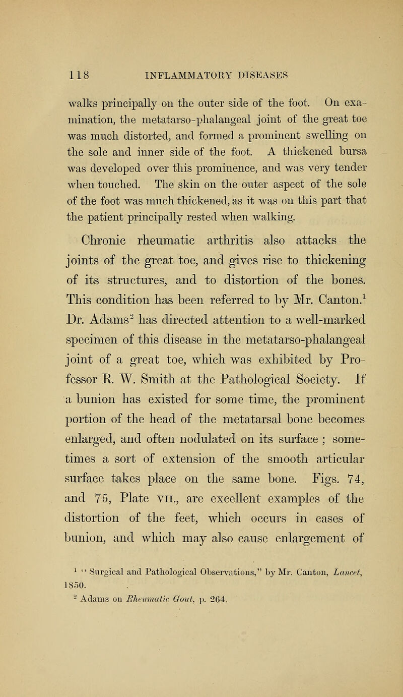 walks principally on the outer side of the foot. On exa- mination, the metatarsophalangeal joint of the great toe was much distorted, and formed a prominent swelling on the sole and inner side of the foot. A thickened bursa was developed over this prominence, and was very tender when touched. The skin on the outer aspect of the sole of the foot was much thickened, as it was on this part that the patient principally rested when walking. Chronic rheumatic arthritis also attacks the joints of the great toe, and gives rise to thickening of its structures, and to distortion of the bones. This condition has been referred to by Mr. Canton.1 Dr. Adams2 has directed attention to a well-marked specimen of this disease in the metatarso-phalangeal joint of a great toe, which was exhibited by Pro- fessor R W. Smith at the Pathological Society. If a bunion has existed for some time, the prominent portion of the head of the metatarsal bone becomes enlarged, and often nodulated on its surface; some- times a sort of extension of the smooth articular surface takes place on the same bone. Figs. 74, and 75, Plate vn., are excellent examples of the distortion of the feet, which occurs in cases of bunion, and which may also cause enlargement of 1  Surgical and Pathological Observations, by Mr. Canton, Lancet, 1850. - Adams on Ehewmatic Gout, p. 264.