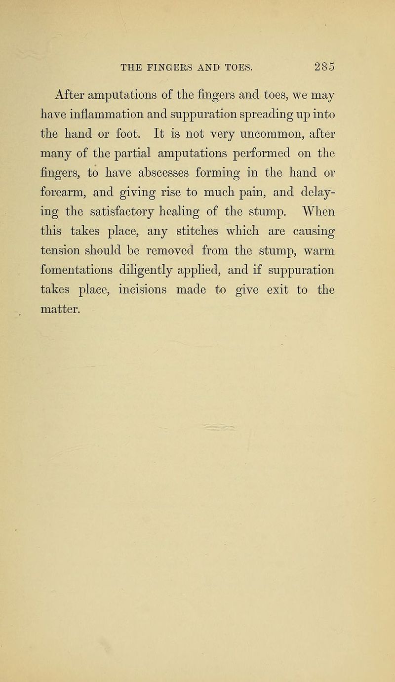After amputations of the fingers and toes, we may have inflammation and suppuration spreading up into the hand or foot. It is not very uncommon, after many of the partial amputations performed on the fingers, to have abscesses forming in the hand or forearm, and giving rise to much pain, and delay- ing the satisfactory healing of the stump. When this takes place, any stitches which are causing tension should be removed from the stump, warm fomentations diligently applied, and if suppuration takes place, incisions made to give exit to the matter.