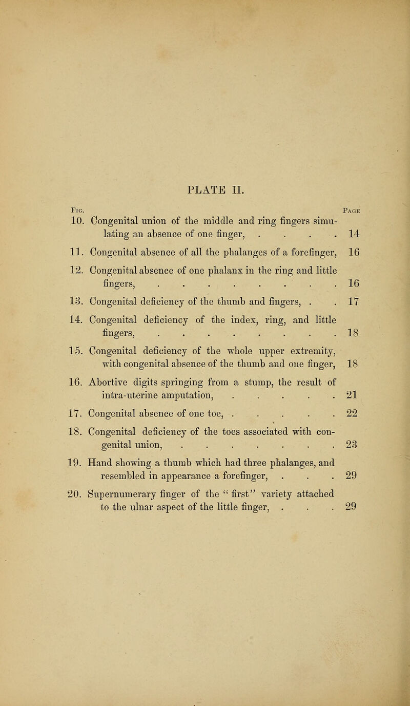 Fig. Page 10. Congenital union of the middle and ring fingers simu- lating an absence of one finger, . . . .14 11. Congenital absence of all the phalanges of a forefinger, 16 12. Congenital absence of one phalanx in the ring and little fingers, . . . . . . . .16 13. Congenital deficiency of the thumb and fingers, . . 17 14. Congenital deficiency of the index, ring, and little fingers, ........ 18 15. Congenital deficiency of the whole upper extremity, with congenital absence of the thumb and one finger, 18 16. Abortive digits springing from a stump, the result of intra-uterine amputation, . . . . .21 17. Congenital absence of one toe, . . . . .22 18. Congenital deficiency of the toes associated with con- genital union, . . . . . . .23 19. Hand showing a thumb which had three phalanges, and resembled in appearance a forefinger, . . .29 20. Supernumerary finger of the  first variety attached to the ulnar aspect of the little finger, . . .29