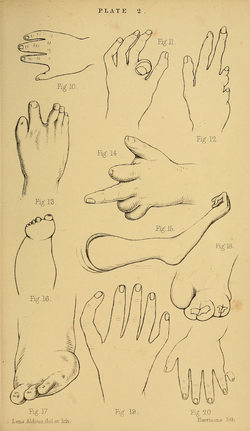 Fig.17. L ens -Aldaus, del et ILth: PiV. 19 Eg 20 Harris oils Lifih