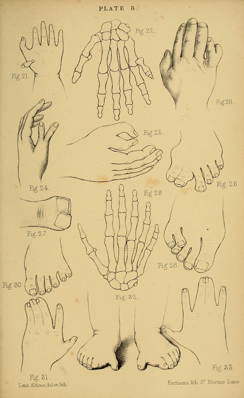 Eg-21 Eg. 30 / Eg23. Eg. 26 Eg. 31. 1 ens _AId0LLS, del et Mi: Fig. 8 3 Harmons HL: St Martins Lane