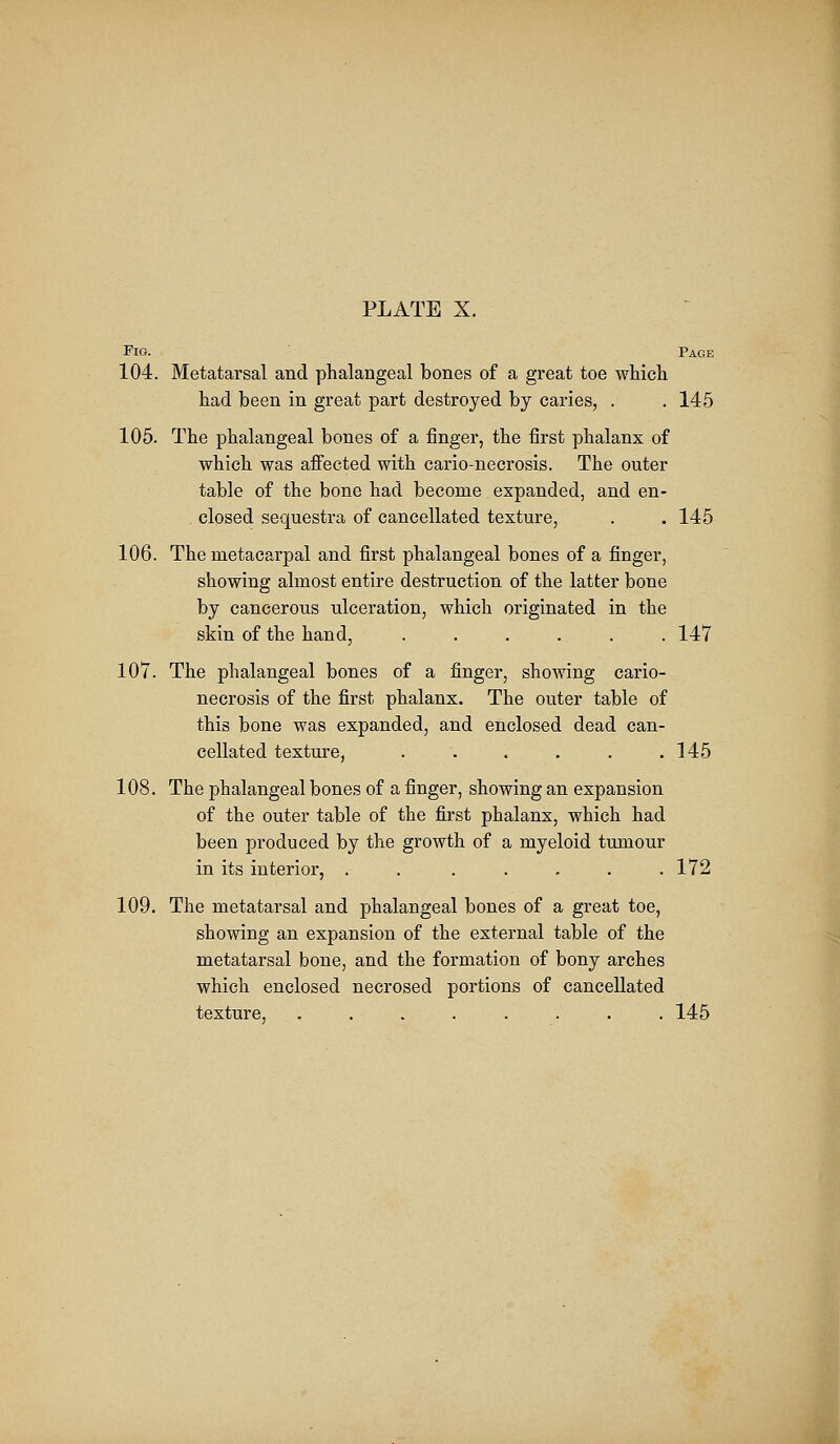 Fig. Page 104. Metatarsal and phalangeal bones of a great toe which had been in great part destroyed by caries, . . 145 105. The phalangeal bones of a finger, the first phalanx of which was affected with cario-necrosis. The outer table of the bone had become expanded, and en- closed sequestra of cancellated texture, . . 145 106. The metacarpal and first phalangeal bones of a finger, showing almost entire destruction of the latter bone by cancerous ulceration, which originated in the skin of the hand, ...... 147 107. The phalangeal bones of a finger, showing cario- necrosis of the first phalanx. The outer table of this bone was expanded, and enclosed dead can- cellated texture, . . . . . .145 108. The phalangeal bones of a finger, showing an expansion of the outer table of the first phalanx, which had been produced by the growth of a myeloid tumour in its interior, . . . . . . .172 109. The metatarsal and phalangeal bones of a great toe, showing an expansion of the external table of the metatarsal bone, and the formation of bony arches which enclosed necrosed portions of cancellated texture, ........ 145