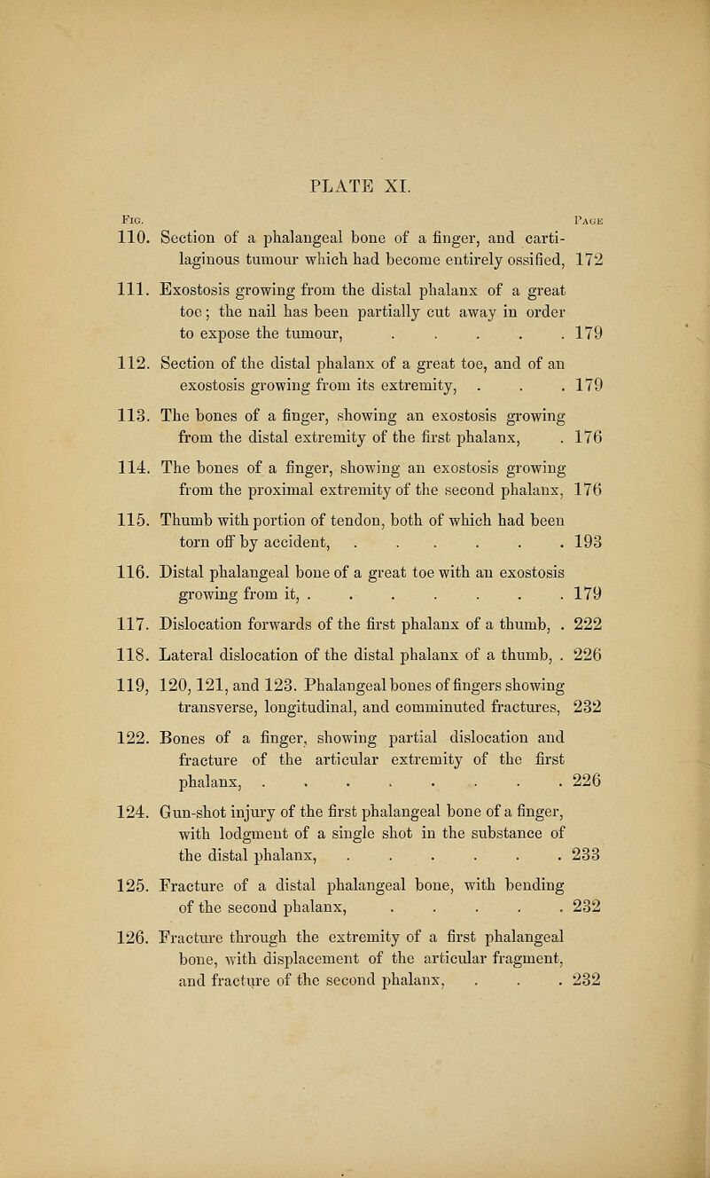 Fig. Page 110. Section of a phalangeal bone of a finger, and carti- laginous tumour which had become entirely ossified, 172 111. Exostosis growing from the distal phalanx of a great toe; the nail has been partially cut away in order to expose the tumour, . . . . .179 112. Section of the distal phalanx of a great toe, and of an exostosis growing from its extremity, . . .179 113. The bones of a finger, showing an exostosis growing from the distal extremity of the first phalanx, . 176 114. The bones of a finger, showing an exostosis growing from the proximal extremity of the second phalanx, 176 115. Thumb with portion of tendon, both of which had been torn off by accident, ...... 193 116. Distal phalangeal bone of a great toe with an exostosis growing from it, . . . . . . .179 117. Dislocation forwards of the first phalanx of a thumb, . 222 118. Lateral dislocation of the distal phalanx of a thumb, . 226 119. 120,121, and 123. Phalangeal bones of fingers showing transverse, longitudinal, and comminuted fractures, 232 122. Bones of a finger, showing partial dislocation and fracture of the articular extremity of the first phalanx, ........ 226 124. Gun-shot injury of the first phalangeal bone of a finger, with lodgment of a single shot in the substance of the distal phalanx, ...... 233 125. Fracture of a distal phalangeal bone, with bending of the second phalanx, ..... 232 126. Fracture through the extremity of a first phalangeal bone, with displacement of the articular fragment, and fracture of the second phalanx, . . . 232
