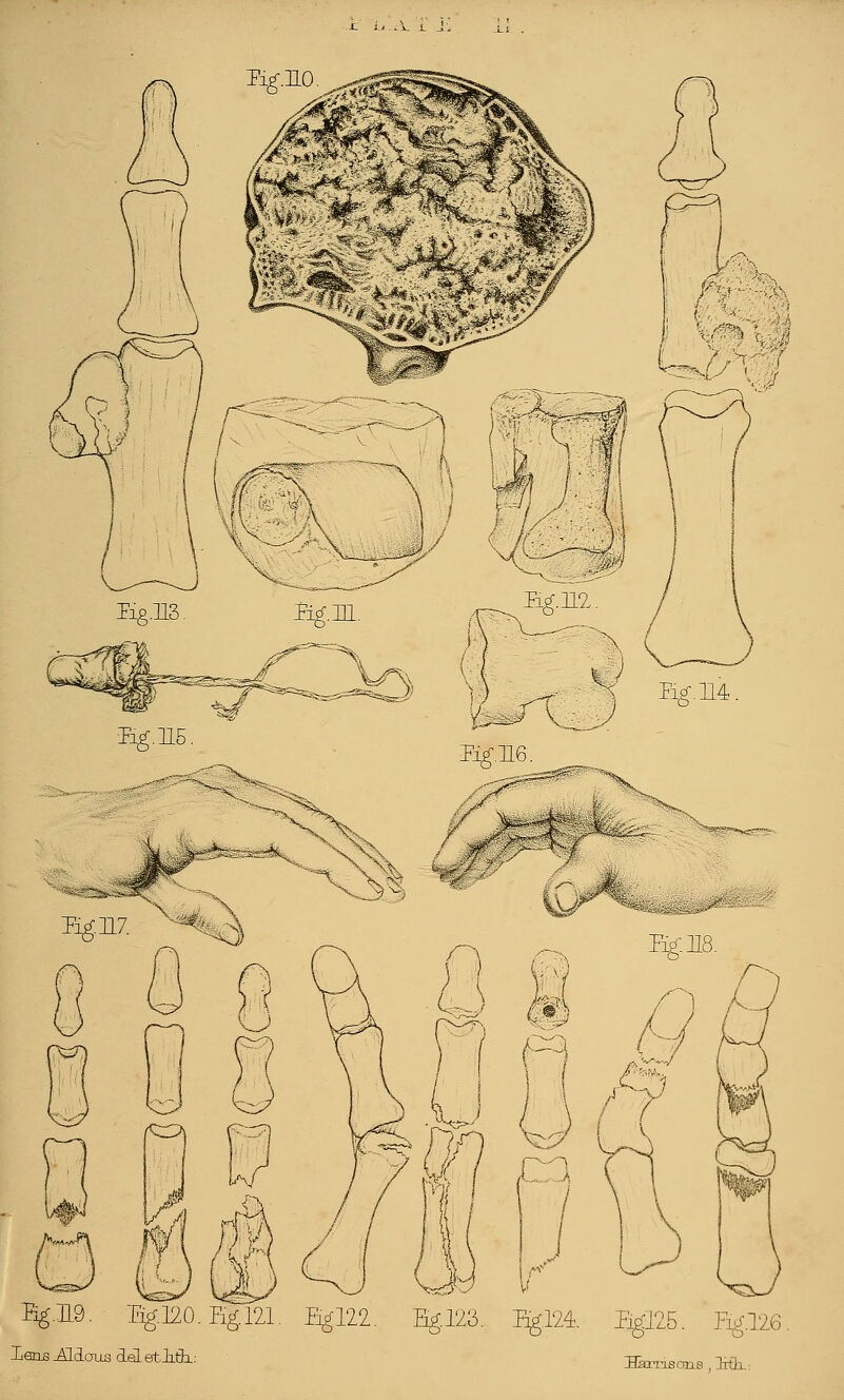 x ii-A. j_ J: Bg.H9. Eg.120.Eg.121. Bfll. %123. Igl24. Bg:T25. Bg.126 lens .ALlaus deLetJith,: Harrisons , ML: