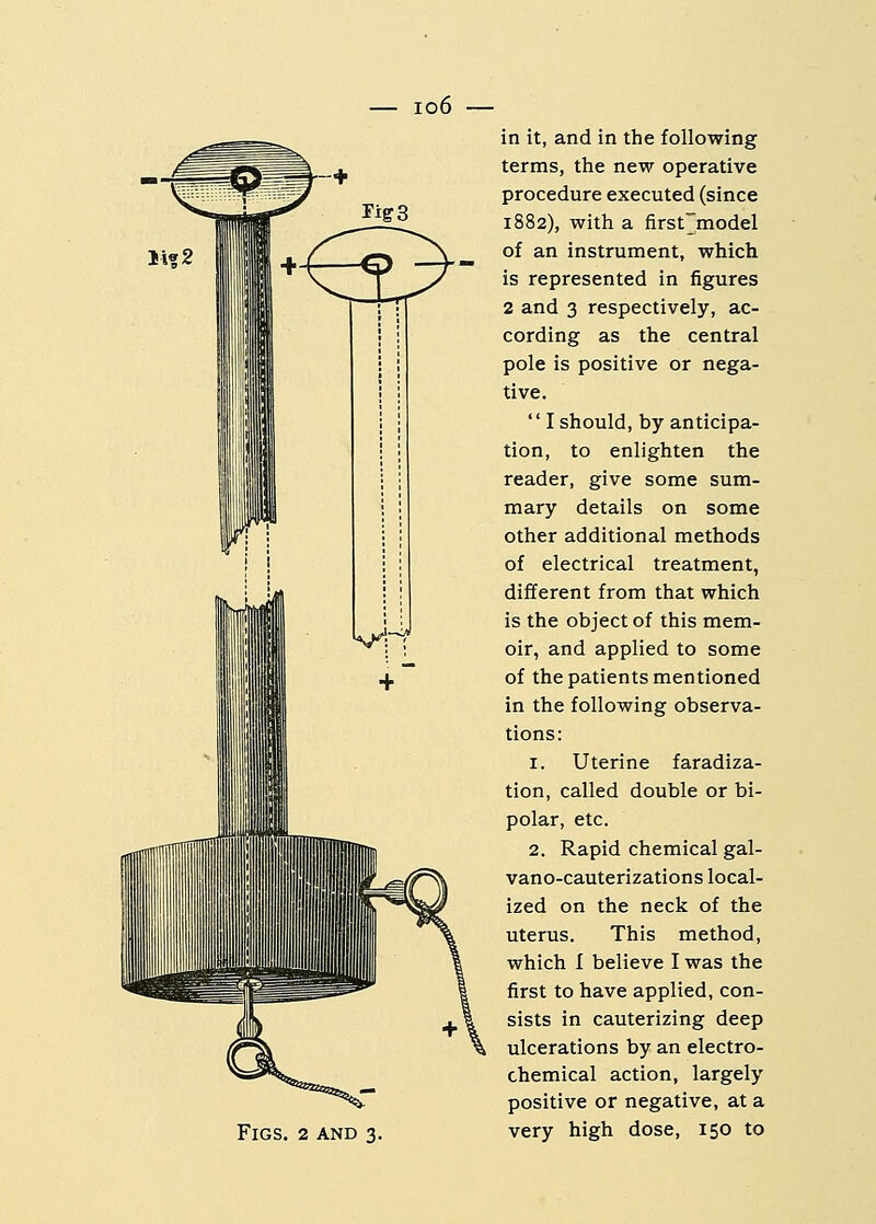 io6 Figs. 2 and 3. in it, and in the following terms, the new operative procedure executed (since 1882), with a firstjnodel of an instrument, which is represented in figures 2 and 3 respectively, ac- cording as the central pole is positive or nega- tive.  I should, by anticipa- tion, to enlighten the reader, give some sum- mary details on some other additional methods of electrical treatment, different from that which is the object of this mem- oir, and applied to some of the patients mentioned in the following observa- tions: 1. Uterine faradiza- tion, called double or bi- polar, etc. 2. Rapid chemical gal- vano-cauterizations local- ized on the neck of the uterus. This method, which I believe I was the first to have applied, con- sists in cauterizing deep ulcerations by an electro- chemical action, largely positive or negative, at a very high dose, 150 to