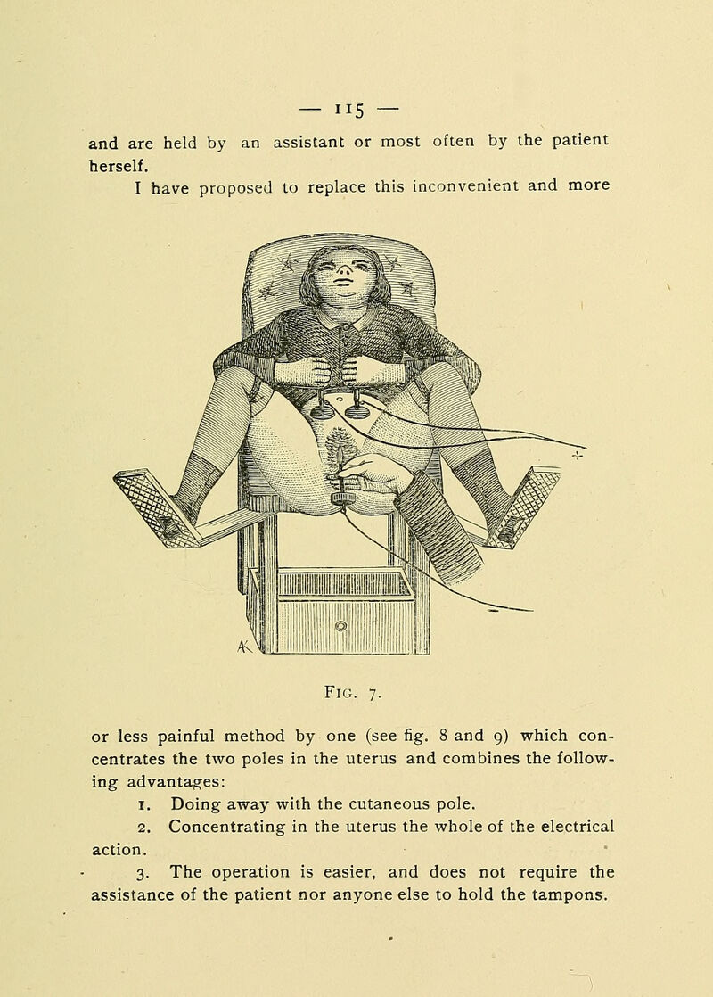 and are held by an assistant or most often by the patient herself. I have proposed to replace this inconvenient and more Fig. 7. or less painful method by one (see fig. 8 and 9) which con- centrates the two poles in the uterus and combines the follow- ing advantages: 1. Doing away with the cutaneous pole. 2. Concentrating in the uterus the whole of the electrical action. 3. The operation is easier, and does not require the assistance of the patient nor anyone else to hold the tampons.