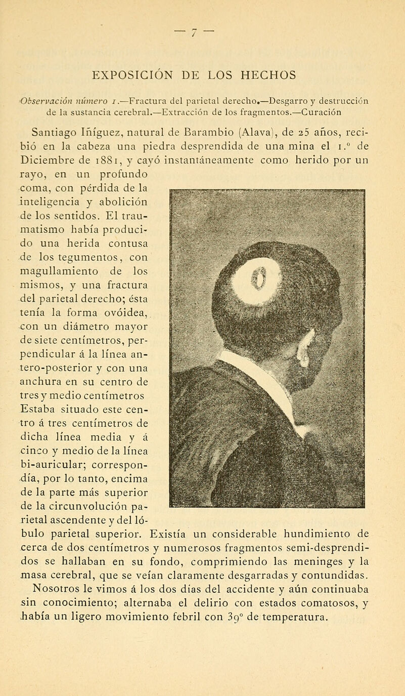 EXPOSICIÓN DE LOS HECHOS 'Observación número j.—Fractura del parietal derecho.—Desgarro y destrucción de la sustancia cerebral.—Extracción de los fragmentos.—Curación Santiago Iñíguez, natural de Barambio (Álava), de 25 años, reci- bió en la cabeza una piedra desprendida de una mina el i. de Diciembre de 1881, y cayó instantáneamente como herido por un rayo, en un profundo coma, con pérdida de la inteligencia y abolición de los sentidos. El trau- matismo había produci- do una herida contusa de los tegumentos, con magullamiento de los mismos, y una fractura del parietal derecho; ésta tenía la forma ovoidea, con un diámetro mayor de siete centímetros, per- pendicular á la línea an- tero-posterior y con una anchura en su centro de tres y medio centímetros Estaba situado este cen- tro á tres centímetros de dicha línea media y á cinco y medio de la línea bi-auricular; correspon- -día, por lo tanto, encima de la parte más superior de la circunvolución pa- rietal ascendente y del ló- bulo parietal superior. Existía un considerable hundimiento de .cerca de dos centímetros y numerosos fragmentos semi-desprendi- dos se hallaban en su fondo, comprimiendo las meninges y la masa cerebral, que se veían claramente desgarradas y contundidas. Nosotros le vimos á los dos días del accidente y aún continuaba sin conocimiento; alternaba el delirio con estados comatosos, y iiabía un ligero movimiento febril con 39° de temperatura.