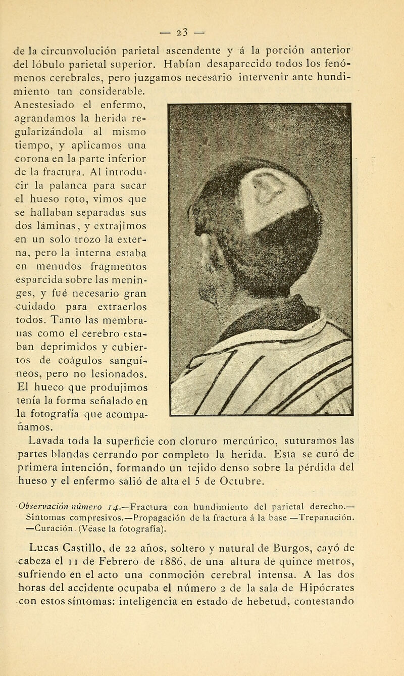 de la circunvolución parietal ascendente y á la porción anterior •del lóbulo parietal superior. Habían desaparecido todos los fenó- menos cerebrales, pero juzgamos neces-ario intervenir ante hundi- miento tan considerable. Anestesiado el enfermo, agrandamos la herida re- gularizándola al mismo tiempo, y aplicamos una corona en la parte inferior de la fractura. Al introdu- cir la palanca para sacar el hueso roto, vimos que se hallaban separadas sus dos láminas, y extrajimos en un solo trozo la exter- na, pero la interna estaba en menudos fragmentos esparcida sobre las menin- ges, y fué necesario gran cuidado para extraerlos todos. Tanto las membra- nas como el cerebro esta- ban deprimidos y cubier- tos de coágulos sanguí- neos, pero no lesionados. El hueco que produjimos tenía la forma señalado en la fotografía que acompa- ñamos. Lavada toda la superficie con cloruro mercúrico, suturamos las partes blandas cerrando por completo la herida. Esta se curó de primera intención, formando un tejido denso sobre la pérdida del hueso y el enfermo salió de alta el 5 de Octubre. Observación número 74.—Fractura con hundimiento del parietal derecho.— Síntomas compresivos.—Propagación de la fractura á la base —Trepanación. —Curación, (Véase la fotografía). Lucas Castillo, de 22 años, soltero y natural de Burgos, cayó de cabeza el 11 de Febrero de 1886, de una altura de quince metros, sufriendo en el acto una conmoción cerebral intensa. A las dos horas del accidente ocupaba el número 2 de la sala de Hipócrates con estos síntomas: inteligencia en estado de hebetud. contestando