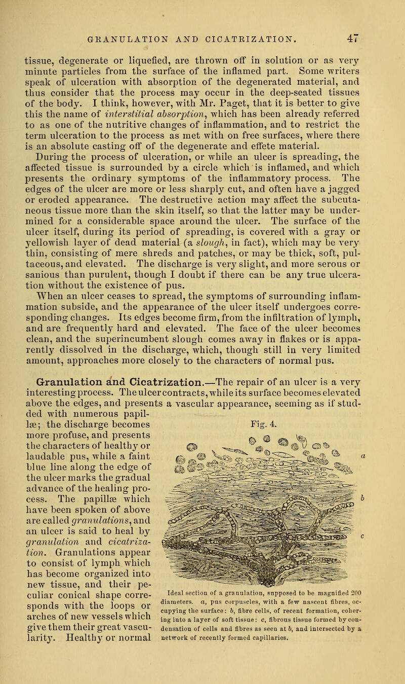 GKANULATION AND CICATRIZATION. 4< tissue, degenerate or liquefied, are thrown off in solution or as very minute particles from the surface of the inflamed part. Some writers speak of ulceration with absorption of the degenerated material, and thus consider that the process may occur in the deep-seated tissues of the body. I think, however, with Mr. Paget, that it is better to give this the name of interstitial absorption, which has been already referred to as one of the nutritive changes of inflammation, and to restrict the term ulceration to the process as met with on free surfaces, where there is an absolute casting off of the degenerate and effete material. During the process of ulceration, or while an ulcer is spreading, the affected tissue is surrounded by a circle which is inflamed, and which presents the ordinary symptoms of the inflammatory process. The edges of the ulcer are more or less sharply cut, and often have a jagged or eroded appearance. The destructive action may affect the subcuta- neous tissue more than the skin itself, so that the latter may be under- mined for a considerable space around the ulcer. The surface of the ulcer itself, during its period of spreading, is covered with a gray or 3''ellowish layer of dead material (a slough, in fact), which may be very thin, consisting of mere shreds and patches, or may be thick, soft, pul- taceous, and elevated. The discharge is very slight, and more serous or sanious than purulent, though I doubt if there can be any true ulcera- tion without the existence of pus. When an ulcer ceases to spread, the symptoms of surrounding inflam- mation subside, and the appearance of the ulcer itself undergoes corre- sponding changes. Its edges become firm, from the infiltration of lymph, and are frequently hard and elevated. The face of the ulcer becomes clean, and the superincumbent slough comes away in flakes or is appa- rently dissolved in the discharge, which, though still in very limited amount, approaches more closely to the characters of normal pus. Granulation and Cicatrization.—The repair of an ulcer is a very interesting process. The ulcer contracts, while its surface becomes elevated above the edges, and presents a vascular appearance, seeming as if stud- ded with numerous papil- lae; the discharge becomes Fig. 4. more profuse, and presents the characters of healthy or laudable pus, while a faint blue line along the edge of the ulcer marks the gradual advance of the healing pro- cess. The papillae which have been spoken of above are called granulations, and an ulcer is said to heal by granulation and cicatriza- tion. Granulations appear to consist of lymph which has become organized into new tissue, and their pe- culiar conical shape corre- sponds with the loops or arches of new vessels which give them their great vascu- larit3\ Healthy or normal Ideal section of a gnnul itiou, pnppo'ed to bo nngnifiod 200 di.i.uOte.s. a, pas c./ii,>.-,cles, w.tL a few n.^oCOut fiL^es, oc- cupying the surface: 6, fibre ceUs, of recent formation, coher- ing into a layer of soft tissue: c, fibrous tissue formed by con- densation of cells and fibres as seen at b, and intersected by a net'vrork of recently formed capillaries.