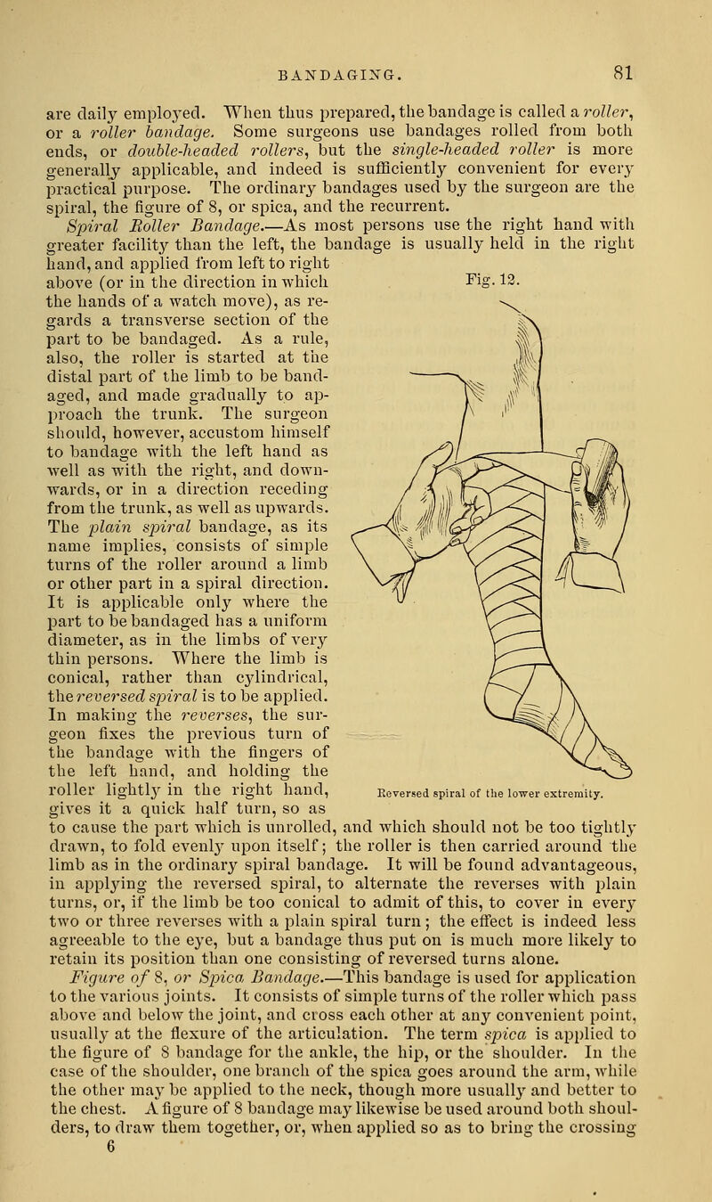 riff. 12. are daily emplo.yecl. When thus prepared, the bandage is called a roller^ or a rolle?- bandage. Some surgeons use bandages rolled from both ends, or double-headed rollers, but the single-headed roller is more generally applicable, and indeed is sufficiently convenient for every practical purpose. The ordinary bandages used by the surgeon are the spiral, the figure of 8, or spica, and the recurrent. Spiral Boiler Bandage.—As most persons use the right hand with greater facilit}'- than the left, the bandage is usually held in the right hand, and applied from left to right above (or in the direction in which the hands of a watch move), as re- gards a transverse section of the part to be bandaged. As a rule, also, the roller is started at the distal part of the limb to be band- aged, and made gradually to ap- proach the trunk. The surgeon should, however, accustom himself to bandage with the left hand as well as with the right, and down- wards, or in a direction receding from the trunk, as well as upwards. The plain spiral bandage, as its name implies, consists of simple turns of the roller around a limb or other part in a spiral direction. It is applicable only where the part to be bandaged has a uniform diameter, as in the limbs of A^ery thin persons. Where the limb is conical, rather than cylindrical, fhQreversed spiral is to be applied. In making the reverses, the sur- geon fixes the previous turn of the bandage with the fingers of the left hand, and holding the roller lightly'' in the right hand, gives it a quick half turn, so as to cause the part which is unrolled, and which should not be too tightly drawn, to fold evenl}^ upon itself; the roller is then carried around the limb as in the ordinary spiral bandage. It will be found advantageous, in applying the reversed spiral, to alternate the reverses with plain turns, or, if the limb be too conical to admit of this, to cover in every two or three reverses with a plain spiral turn; the effect is indeed less agreeable to the eye, but a bandage thus put on is much more likely to retain its position than one consisting of reversed turns alone. Figure of 8, or Spica Bandage.—This bandage is used for application to the various joints. It consists of simple turns of the roller which pass above and below the joint, and cross each other at any convenient point, usually at the flexure of the articulation. The term spica is applied to the figure of 8 bandage for the ankle, the hip, or the shoulder. In the case of the shoulder, one branch of the spica goes around the arm, Avhile the other may be applied to the neck, though more usually and better to the chest. A figure of 8 bandage may likewise be used around both shoul- ders, to draw them together, or, when applied so as to bring the crossing 6 Eeversed spiral of the lower extremity.