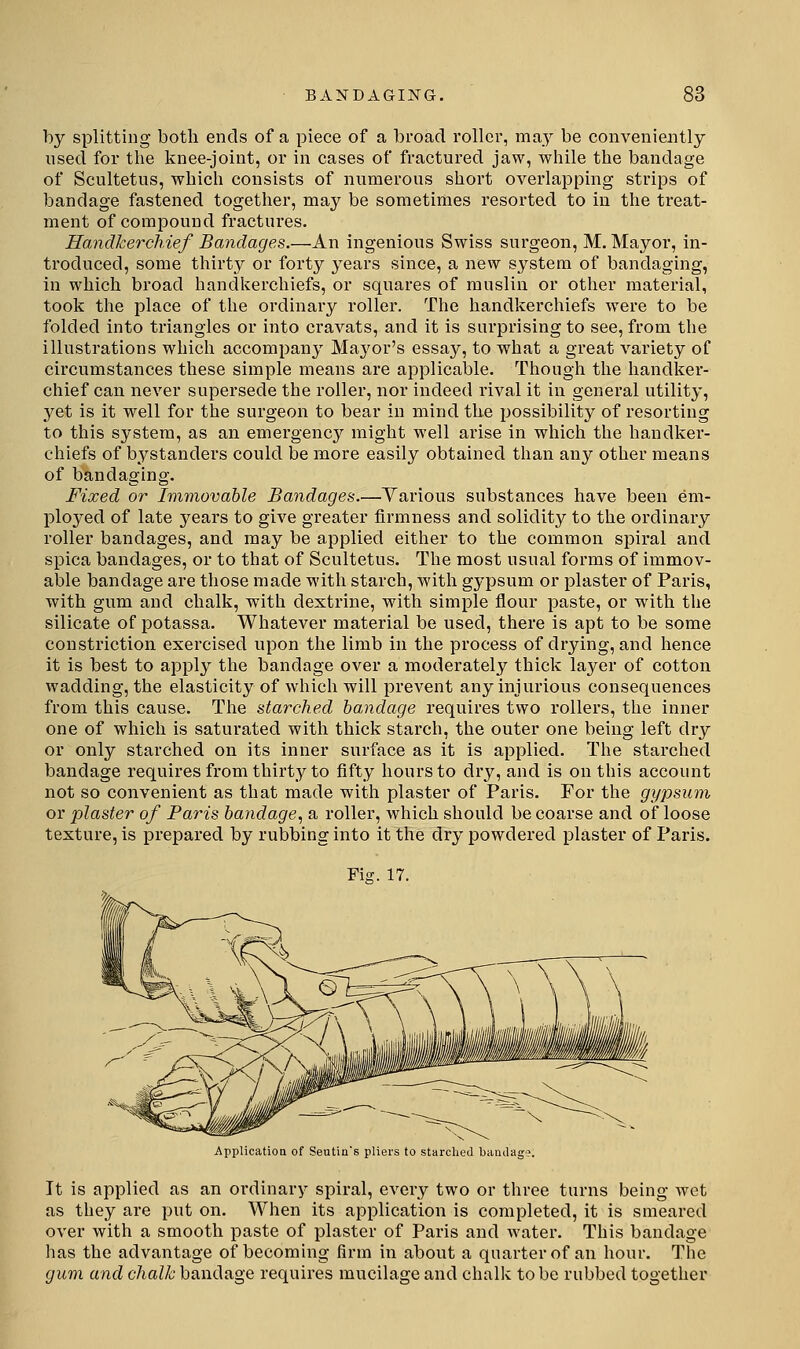 by splitting botli ends of a piece of a broad roller, ma_y be convenieaitly used for the knee-joint, or in cases of fractured jaw, while the bandage of Scultetus, which consists of numerous short overlapping strips of bandage fastened together, may be sometimes resorted to in the treat- ment of compound fractures. Handkerchief Bandages.—An ingenious Swiss surgeon, M, Mayor, in- troduced, some thirty or forty years since, a nevv system of bandaging, in which broad handkerchiefs, or squares of muslin or other material, took the place of the ordinary roller. The handkerchiefs were to be folded into triangles or into cravats, and it is surprising to see, from the illustrations which accompany Mayor's essay, to what a gi'eat variety of circumstances these simple means are applicable. Though the handker- chief can never supersede the roller, nor indeed rival it in general utility, 3^et is it well for the surgeon to bear in mind the possibility of resorting to this system, as an emergency might well arise in which the handker- chiefs of bystanders could be more easily obtained than any other means of bandaging. Fixed or Immovable Bandages.—Various substances have been em- l^loyed of late years to give greater firmness and solidity to the ordinary roller bandages, and may be applied either to the common spiral and spica bandages, or to that of Scultetus. The most usual forms of immov- able bandage are those made with starch, with gypsum or plaster of Paris, with gum and chalk, with dextrine, with simple flour paste, or with the silicate of potassa. Whatever material be used, there is apt to be some constriction exercised upon the limb in the process of drying, and hence it is best to apply the bandage over a moderately thick layer of cotton wadding, the elasticity of which will prevent any injurious consequences from this cause. The starched bandage requires two rollers, the inner one of which is saturated with thick starch, the outer one being left dry or only starched on its inner surface as it is applied. The starched bandage requires from thirty to fifty hours to dry, and is on this account not so convenient as that made with plaster of Paris. For the gypsum or plaster of Paris bandage.^ a roller, which should be coarse and of loose texture, is larepared by rubbing into it the dry powdered plaster of Paris. Fis;. 17. Application of Seutin's pliers to starched baiulag?. It is applied as an oi'dinary spiral, every two or three turns being wet as they are put on. When its application is completed, it is smeared over with a smooth paste of plaster of Paris and water. This bandage has the advantage of becoming firm in about a quarter of an hour. The gum and chalk bandage requires mucilage and chalk to be rubbed together