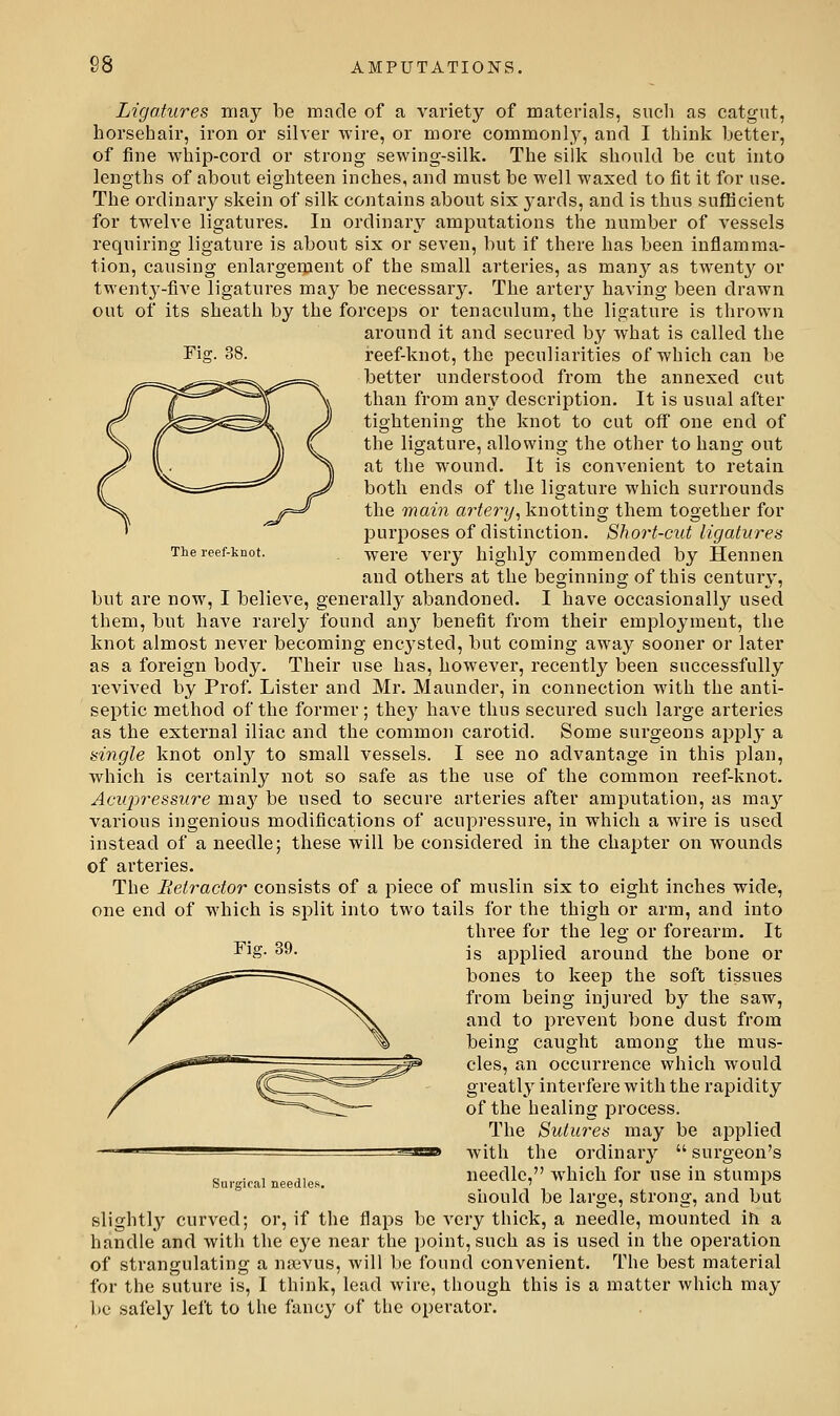 88 Fig. 88. The reef-knot. Ligatures may be made of a variety of materials, such as catgut, horsehair, iron or silver wire, or more commonly, and I think better, of fine whip-cord or strong sewing-silk. The silk should be cut into lengths of about eighteen inches, and must be well waxed to fit it for use. The ordinary skein of silk contains about six yards, and is thus sufficient for twelve ligatures. In ordinary amputations the number of vessels requiring ligature is about six or seven, but if there has been inflamma- tion, causing enlargement of the small arteries, as many as twenty or twenty-five ligatures may be necessary. The artery having been drawn out of its sheath by the forceps or tenaculum, the ligature is thrown around it and secured by what is called the reef-knot, the peculiarities of which can be better understood from the annexed cut than from any description. It is usual after tightening the knot to cut off one end of the ligature, allowing the other to hang out at the wound. It is convenient to retain both ends of the ligature which surrounds the main arter-ij, knotting them together for purposes of distinction. Short-cut ligatures were very highly commended by Hennen and others at the beginning of this century, but are now, I believe, generally abandoned. I have occasionally used them, but have rarely found any benefit from their employment, the knot almost never becoming encysted, but coming away sooner or later as a foreign body. Their use has, however, recently been successfully revived by Prof. Lister and Mr. Maunder, in connection with the anti- septic method of the former; thej' have thus secured such large arteries as the external iliac and the common carotid. Some surgeons apj^ly a single knot only to small vessels. I see no advantage in this plan, which is certainly not so safe as the use of the common reef-knot. Aciqyressure may be used to secure arteries after amputation, as ma3'- various ingenious modifications of acupressure, in which a wire is used instead of a needle; these will be considered in the chapter on wounds of arteries. The Retractor consists of a piece of muslin six to eight inches wide, one end of which is split into two tails for the thigh or arm, and into three for the leg or forearm. It is applied around the bone or bones to keep the soft tissues from being injured by the saw, and to prevent bone dust from being caught among the mus- cles, an occurrence which would greatly interfere with the rapidity of the healing process. The Sutu7-es may be applied with the ordinar}^ surgeon's needle, which for use in stumps should be large, strong, and but slightly curved; or, if the flaps be very thick, a needle, mounted iti a handle and with the eye near the point, such as is used in the operation of strangulating a naivus, will be found convenient. The best material for the suture is, I think, lead wire, though this is a matter which may be safely left to the fancy of the operator. Fig. 39. Surgical needles.