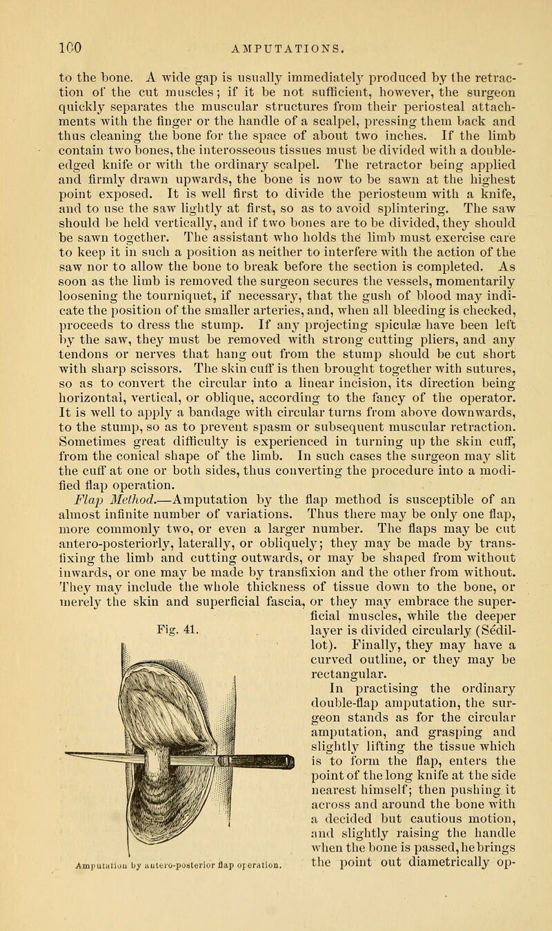 to the bone. A wide gap is usually immediately produced by the retrac- tion of the cut muscles; if it be not sufficient, however, the surgeon quickly separates the muscular structures from their periosteal attach- ments with the finger or the handle of a scalpel, pressing them back and thus cleaning the bone for the space of about two inches. If the limb contain two bones, the interosseous tissues must be divided with a double- edged knife or with the ordinar}^ scalpel. The retractor being applied and firmly drawn upwards, the bone is now to be sawn at the highest point exposed. It is well first to divide the periosteum with a knife, and to use the saw lightly at first, so as to avoid splintering. The saw should be held vertically, and if two bones are to be divided, they should be sawn together. The assistant who holds the limb must exercise care to keep it in such a position as neither to interfere with the action of the saw nor to allow the bone to break before the section is completed. As soon as the limb is removed the surgeon secures the vessels, momentarily loosening the tourniquet, if necessary, that the gush of blood may indi- cate the position of the smaller arteries, and, when all bleeding is checked, proceeds to dress the stump. If any projecting spiculse have been left by the saw, they must be removed with strong cutting pliers, and any tendons or nerves that hang out from the stump should be cut short with sharp scissors. The skin cuff is then brought together with sutures, so as to convert the circular into a linear incision, its direction being horizontal, vertical, or oblique, according to the fancy of the operator. It is well to apply a bandage with circular turns from above downwards, to the stump, so as to prevent spasm or subsequent muscular retraction. Sometimes great difficulty is experienced in turning up the skin cuff, from the conical shape of the limb. In such cases the surgeon may slit the cuff at one or both sides, thus converting the procedure into a modi- fied flap operation. Flap Method.—Amputation by the flap method is susceptible of an almost infinite number of variations. Thus there may be only one flap, more commonly two, or even a larger number. The flaps may be cut antero-posteriorly, laterally, or obliquely; they may be made by trans- fixing the limb and cutting outwards, or may be shaped from without inwards, or one may be made by transfixion and the other from without. They may include the whole thickness of tissue down to the bone, or merely the skin and superficial fascia, or they may embrace the super- ficial muscles, while the deeper layer is divided circularly (Sedil- lot). Finally, they may have a curved outline, or they may be rectangular. In practising the ordinary double-flap amputation, the sur- geon stands as for the circular amputation, and grasping and slightl}^ lifting the tissue which is to form the flap, enters the point of the long knife at the side nearest himself; then pushing it across and around the bone with a decided but cautious motion, and slightly raising the handle when the bone is passed, he brings Amputaiiuubyiiiiitio-pusteriorflaporeration. the point out diametrically op-