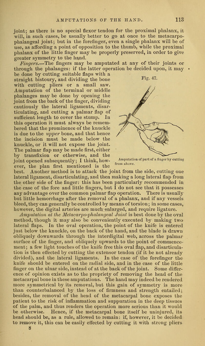 joint; as there is no special flexor tendon for the proximal phalanx, it will, in such cases, be usually better to go at once to the metacarpo- phalangeal joint; but in the forefinger, even a single phalanx will be of use, as affording a point of opposition to the thumb, while the proximal phalanx of the little finger may be properly preserved, in order to give greater symmetry to the hand. Fingers.—The fingers may be amputated at any of their joints or through the phalanges: if the latter operation be decided upon, it may be done by cutting suitable flaps with a straight bistoury, and dividing the bone -^^o- ^'^• with cutting pliers or a small saw. Amputation of the terminal or middle phalanges may be done by opening the joint from the back of the finger, dividing cautiously the lateral ligaments, disar- ticulating, and cutting a palmar flap of sufficient length to cover the stump. In this operation it must always be remem- bered that the prominence of the knuckle is due to the upper bone, and that hence the incision must be made below the knuckle, or it will not expose the joint. The palmar flap may be made first, either by transfixion or otherwise, and the joint opened subsequently; I think, how- Amputation ofpart of a Anger by cutting K , rL J. J.- J • iU from above. ever, the plan first mentioned is the best. Another method is to attack the joint from the side, cutting one lateral ligament, disarticulating, and then making a long lateral flap from the other side of the finger: this has been particularly recommended in the case of the fore and little fingers, but I do not see that it possesses any advantage over the common palmar flap operation. There is usually but little hemorrhage after the removal of a phalanx, and if any vessels bleed, they can generally be controlled by means of torsion; in some cases, however, the digital arteries are much enlarged, and require ligature. Amputation at the Metacarp)0-plialangeal Joint is best done by the oval method, though it may also be conveniently executed by making two lateral flaps. In the oval operation, the point of the knife is entered just below the knuckle, on the back of the hand, and the blade is drawn obliquely downwards through the interdigital web, across the palmar surface of the finger, and obliquely upwards to the point of commence- ment; a few light touches of the knife free this oval flap, and disarticula- tion is then eftected by cutting the extensor tendon (if it be not already divided), and the lateral ligaments. In the case of the forefinger the knife should be entered on the radial side, and in the case of the little finger on the ulnar side, instead of at the back of the joint. Some differ- ence of opinion exists as to the propriety of removing the head of the metacarpal bone in these amputations. The hand may indeed be rendered more symmetrical by its removal, but this gain of symmetry is more than counterbalanced by the loss of firmness and strength entailed; besides, the removal of the head of the metacarpal bone exposes the patient to the risk of inflammation and suppuration in the deep tissues of the palm, and thus renders the operation more serious than it would be otherwise. Hence, if the metacarpal bone itself be uninjured, its head should be, as a rule, allowed to remain: if, however, it be decided to remove it, this can be easily effected by cutting it with strong pliers 8
