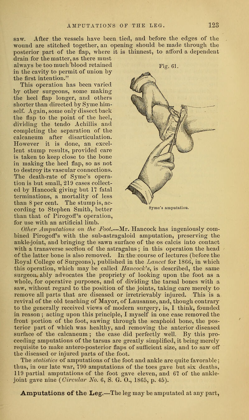 saw. After the vessels have been tied, and before the edges of the wound are stitched together, an opening should be made through the posterior part of the flap, where it is thinnest, to afford a dependent drain for the matter, as there must always be too much blood retained in the cavity to permit of union by the first intention. This operation has been varied by other surgeons, some making the heel flap longer, and others shorter than directed Iby Syme him- self. Again, some only dissect back the flap to the point of the heel, dividing the tendo Achillis and completing the separation of the calcaneum after disarticulation. However it is done, an excel- lent stump results, provided care is taken to keep close to the bone in making the heel flap, so as not to destx'oy its vascular connections. The death-rate of Syme's opera- tion is but small, 219 cases collect- ed by Hancock giving but It fatal terminations, a mortality of less than 8 per cent. The stump is, ac- cording to Stephen Smith, better than that of Pirogoff's operation, for use with an artificial limb. Other Amputations on the Foot.—Mr. Hancock has ingeniously com- bined Pirogoff's with the sub-astragaloid amputation, preserving the ankle-joint, and bringing the sawn surface of the os calcis into contact with a transverse section of the astragalus; in this operation the head of the latter bone is also removed. In the course of lectures (before the Royal College of Surgeons), published in the Lancet for 1866, in which this operation, which may be called Hancock^s, is described, the same surgeon, ably advocates the propriety of looking upon the foot as a whole, for operative purposes, and of dividing the tarsal bones with a saw, without regard to the position of the joints, taking care merely to remove all parts that are diseased or irretrievably injured. This is a revival of the old teaching of Mayor, of Lausanne, and, though contrar}^ to the generally received views of modern surgery, is, I think, founded in reason; acting upon this principle, I myself in one case removed the front portion of the foot, sawing through the scaphoid bone, the pos- terior part of which was healthy, and removing the anterior diseased surface of the calcaneum ; the case did perfectly well. By this pro- ceeding amputations of the tarsus are greatly simplified, it being merely requisite to make antero-posterior flaps of sufficient size, and to saw off the diseased or injured parts of the foot. The statistics of amputations of the foot and ankle are quite favorable; thus, in our late war, 790 amputations of the toes gave but six deaths, 119 partial amputations of the foot gave eleven, and 61 of the ankle- joint gave nine (Circular No. 6, S. Gr. 0., 1865, p. 45). Syme's amputatiou. Amputations of the Leg.—The leg may be amputated at any part,