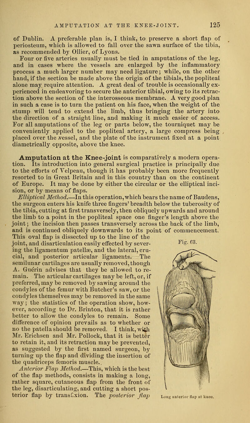 of Dublin. A preferable plan is, I think, to preserve a short flap of periosteum, which is allowed to fall over the sawn surface of the tibia, as recommended by Oilier, of Lyons. Four or five arteries usually must be tied in amputations of the leg, and in cases where the vessels are enlarged by the inflammatory process a much larger number may need ligature; while, on the other hand, if the section be made above the origin of the tibials, the popliteal alone may require attention. A great deal of trouble is occasionally ex- perienced in endeavoring to secure the anterior tibial, owing to its retrac- tion above the section of the interosseous membrane. A very good plan in such a case is to turn the patient on his face, when the weight of the stump will tend to extend the limb, thus bringing the artery into the direction of a straight line, and making it much easier of access. For all amputations of the leg or parts below, the tourniquet may be conveniently applied to the popliteal artery, a large compress being placed over the .vessel, and the plate of the instrument fixed at a point diametrically opposite, above the knee. Amputation at the Knee-joint is comparatively a modern opera- tion. Its introduction into general surgical practice is principally due to the efforts of Yelpeau, though it has probably been more frequently resorted to in Great Britain and in this country than on the continent of Europe. It may be done by either the circular or the elliptical inci- sion, or by means of flaps. Elliptical Method.—In this operation, which bears the name of Baudens, the surgeon enters his knife three fingers' breadth below the tuberosity of the tibia, cutting at first transversely'', then obliquely upwards and around the limb to a point in the popliteal space one finger's length above the joint; the incision then passes transversely across the back of the limb, and is continued obliquely downwards to its point of commencement. This oval fiap is dissected up to the line of the joint, and disarticulation easily efi'ected by sever- ing the ligamentum patellae, and the lateral, cru- cial, and posterior articular ligaments. The semilunar cartilages ai-e usually remoA'ed, though A. Guerin advises that they be allowed to re- main. The articular cartilages maybe left, or, if preferred, may be removed by sawing around the condyles of the femur with Butcher's saw, or the condyles themselves may be removed in the same way; the statistics of the operation show, how- ever, according to Dr. Brinton, that it is rather better to allow the condyles to remain. Some difference of opinion prevails as to whether or no the patella should be removed. I think, wijjjbi Mr. Erichsen and Mr. Pollock, that it is better to retain it, and its retraction may be prevented, as suggested by the first named surgeon, by turning up the flap and dividing the insertion of the quadriceps femoris muscle.. Anterior Flap Method.—This, which is the best of the flap methods, consists in making a long, rather square, cutaneous flap from the front of the leg, disarticulating, and cutting a short pos- terior flap by transCxion. The posterior flap Long anierior Uap at knee. Fis:. G3.