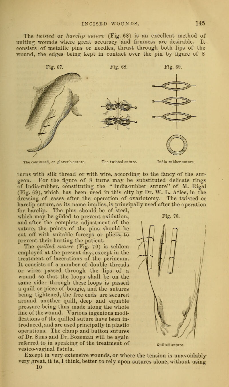 The ticisted or harelip suture (Fig. 68) is an excellent method of uniting wounds where great accuracy' aud firmness are desirable. It consists of metallic pins or needles, thrust through both lips of the wound, the edges being kept in contact over the pin by figure of S Fig. 67. Fi?. 68. Fi?. 69. The continued, or glover's sntnre. The twisted suture. India-rubber suture. turns with silk thread or with wire, according to the fancy of the sur- geon. For the figure of 8 turns may be substituted delicate rings of India-rubber, constituting the India-rubber suture of M. Rigal (Fig. 69), which has been used in this city by Dr. W. L. Atlee. in the dressing of cases after the operation of ovariotomy. The twisted or harelip suture, as its name implies, is principally used after the operation for harelip. The pins should be of steel, which may be gilded to prevent oxidation. Fig. 70. and after the complete adjustment of the suture, the points of the pins should be cut off with suitable forceps or pliers, to prevent their hurting the patient. The quilled suture (Fig. TO) is seldom employed at the present day, except in the treatment of lacerations of the perineum. It consists of a number of double threads or wires passed through the lips of a wound so that the loops shall be on the same side: through these loops is passed a quill or piece of bougie, and the sutures being tighteued, the free ends are secured around another quill, deep and equable pressure being thus made along the whole line of the wound. Various ingenious modi- fications of the quilled suture have been in- troduced, and are used principally in plastic operations. The clamp and button sutures of Dr. Sims and Dr. Bozeman will be again referred to in speaking of the treatment of QuiUed suture. vesico-vaginal fistula. Except in very extensive wounds, or where the tension is unavoidably very great, it is, I think, better to relv upon sutures alone, without using 10