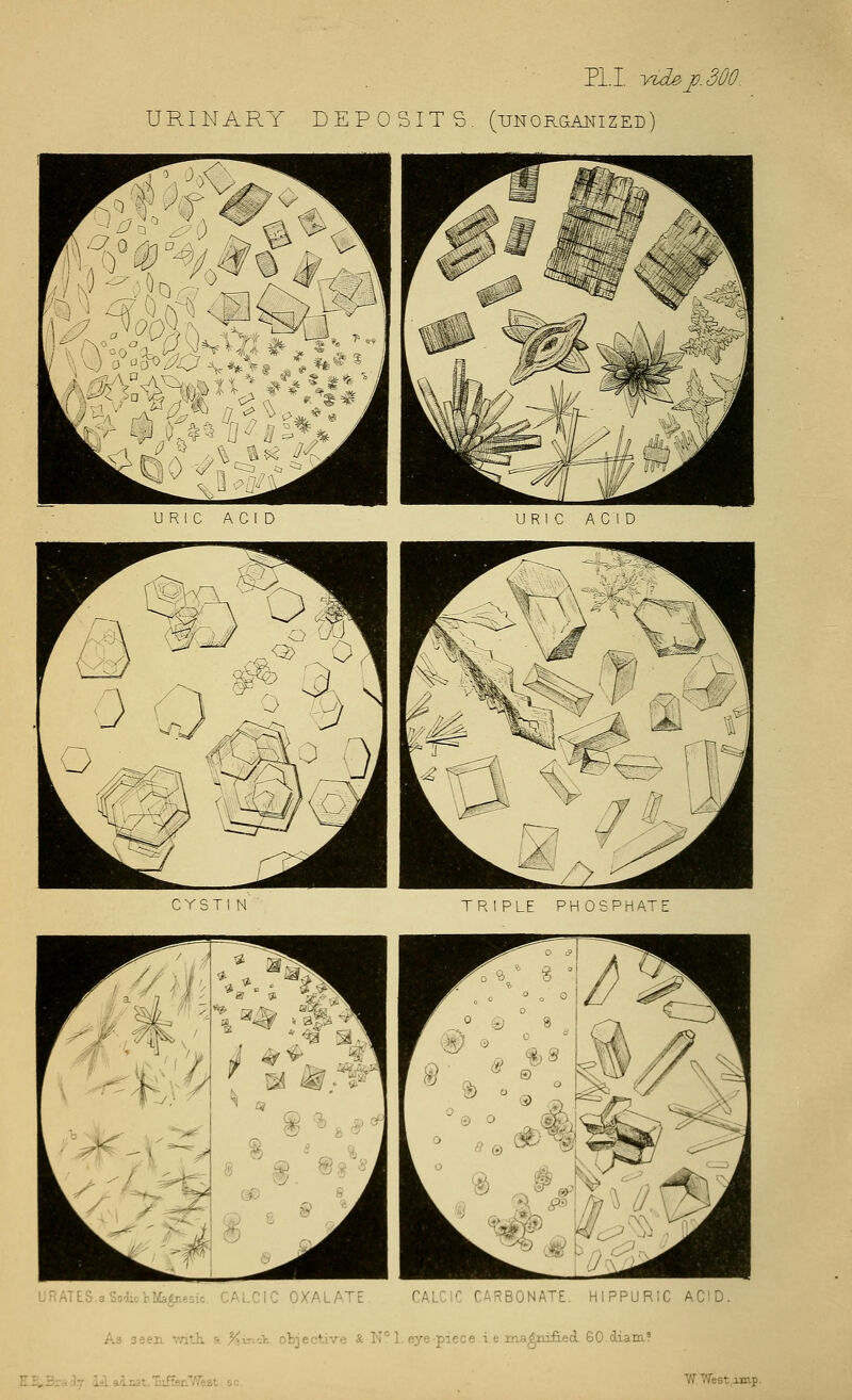 PI. I. yz3£^j). URINARY DEPOSIT S. (unorganized) C Y S T 1 N TRIPLE PHOSPHATE URATLS.aSo'iictlfc^.esic CALCIC OXALATE CALCIC CARBONATE. HIPPURIC AC'D. As seen v/ith. a %,\y^-y, ofcjective & N°l. eye piece ie ina^m£.ecL 60 diam? EE.3ialT LI ao.cat.'Mfer.'/feat sc, 'WWest^amp.