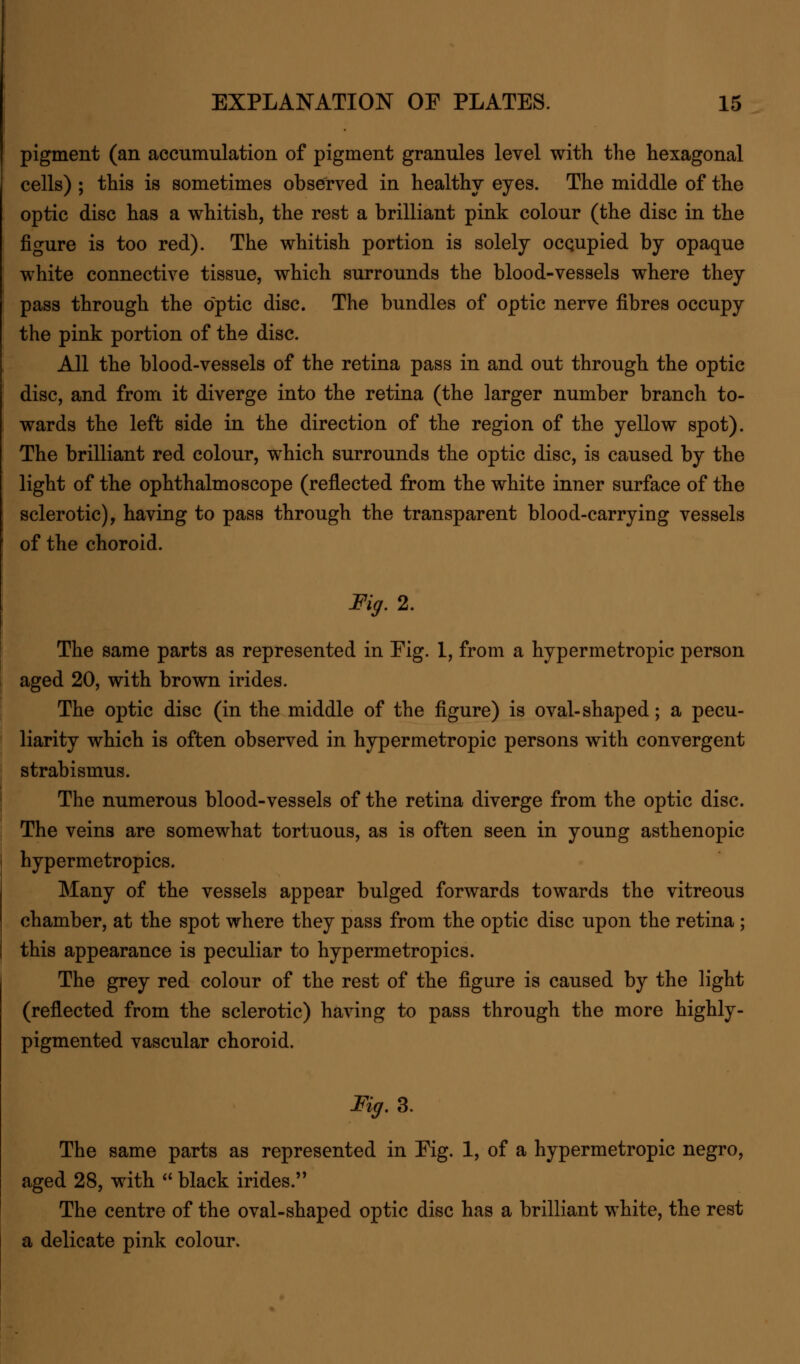 pigment (an accumulation of pigment granules level with the hexagonal cells) ; this is sometimes observed in healthy eyes. The middle of the optic disc has a whitish, the rest a brilliant pink colour (the disc in the figure is too red). The whitish portion is solely occupied by opaque white connective tissue, which surrounds the blood-vessels where they pass through the optic disc. The bundles of optic nerve fibres occupy the pink portion of the disc. All the blood-vessels of the retina pass in and out through the optic disc, and from it diverge into the retina (the larger number branch to- wards the left side in the direction of the region of the yellow spot). The brilliant red colour, which surrounds the optic disc, is caused by the light of the ophthalmoscope (reflected from the white inner surface of the sclerotic), having to pass through the transparent blood-carrying vessels of the choroid. Fig. 2. The same parts as represented in Eig. 1, from a hypermetropic person aged 20, with brown irides. The optic disc (in the middle of the figure) is oval-shaped; a pecu- liarity which is often observed in hypermetropic persons with convergent strabismus. The numerous blood-vessels of the retina diverge from the optic disc. The veins are somewhat tortuous, as is often seen in young asthenopic hypermetropics. Many of the vessels appear bulged forwards towards the vitreous chamber, at the spot where they pass from the optic disc upon the retina ; this appearance is peculiar to hypermetropics. The grey red colour of the rest of the figure is caused by the light (reflected from the sclerotic) having to pass through the more highly - pigmented vascular choroid. Fig. 3. The same parts as represented in Eig. 1, of a hypermetropic negro, aged 28, with  black irides. The centre of the oval-shaped optic disc has a brilliant white, the rest a delicate pink colour.