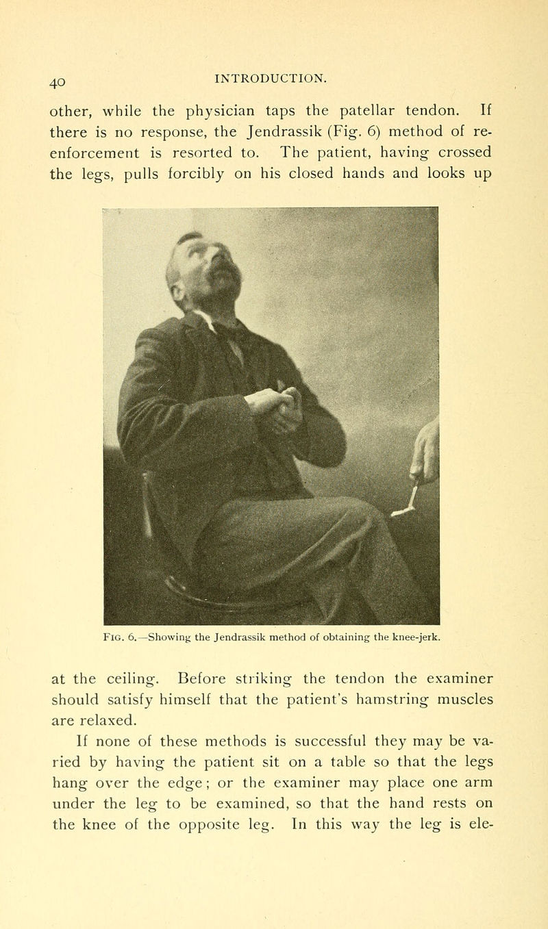 Other, while the physician taps the patellar tendon. If there is no response, the Jendrassik (Fig. 6) method of re- enforcement is resorted to. The patient, having crossed the legs, pulls forcibly on his closed hands and looks up Fig. 6.—Showing the Jendrassik method of obtaining the knee-jerk. at the ceiling. Before striking the tendon the examiner should satisfy himself that the patient's hamstring muscles are relaxed. If none of these methods is successful they may be va- ried by having the patient sit on a table so that the legs hang over the edge ; or the examiner may place one arm under the leg to be examined, so that the hand rests on the knee of the opposite leg. In this way the leg is ele-