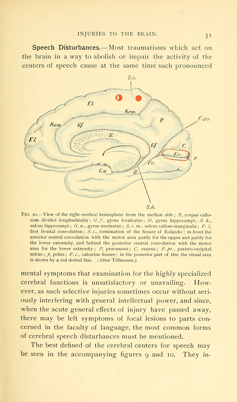 Speech Disturbances.—Most traumatisms which act on the brain in a way to abolish or impair the activity of the centers of speech cause at the same time such pronounced F.po. Fig. 10.—View of the right cerebral hemisphere from the median side ; B, corpus callo- sum divided longitudinally; G.f, gyrus fornicatus ; //, gyrus hippocampi; S. h., sulcus hippocampi; G.u., gyrus uncinatus ; 6. c. tn., sulcus calloso-marginalis ; F. 1, first frontal convolution ; S. c, termination of the fissure of Rolando ; in front the anterior central convolution with the motor area partly for the upper and partly for the lower extremity, and behind the posterior central convolution with the motor area for the lower extremity; P, prascuneus ; C, cuneus ; F.po , parieto-occipital sulcus ; /, polus ; F. c, calcarine fissure ; in the posterior part of this the visual area is shown by a red dotted line. (After Tillmanns.) mental symptoms that examination for the highly specialized cerebral functions is unsatisfactory or unavailing. How- ever, as such selective injuries sometimes occur without seri- ously interfering with general intellectual power, and since, when the acute general effects of injury have passed away, there may be left symptoms of focal lesions to parts con- cerned in the faculty of language, the most common forms of cerebral speech disturbances must be mentioned. The best defined of the cerebral centers for speech may be seen in the accompanying figures 9 and 10. They in-