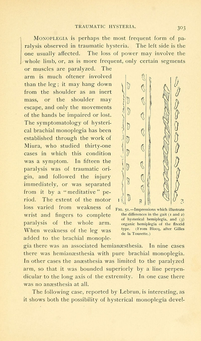 ^l ^ & ^ ■g ^ 5) Q D ^ ^ to; ^ J? 9 I ? ^ ^ ^ 2 ^ 0 Monoplegia is perhaps the most frequent form of pa- ralysis observed in traumatic hysteria. The left side is the one usually affected. The loss of power may involve the whole limb, or, as is more frequent, only certain segments or muscles are paralyzed. The arm is much oftener involved than the leg; it may hang down from the shoulder as an inert mass, or the shoulder may escape, and only the movements of the hands be impaired or lost. The symptomatology of hysteri- cal brachial monoplegia has been established through the work of Miura, who studied thirty-one cases in which this condition was a symptom. In fifteen the paralysis was of traumatic ori- gin, and followed the injury immediately, or was separated from it by a  meditative pe- riod. The extent of the motor loss varied from weakness of wrist and fingers to complete paralysis of the whole arm. When weakness of the leg was added to the brachial monople- gia there was an associated hemiangesthesia. In nine cases there was hemiansesthesia with pure brachial monoplegia. In other cases the anaesthesia was limited to the paral3'zed arm, so that it was bounded superiorly by a line perpen- dicular to the long axis of the extremity. In one case there was no anaesthesia at all. The following case, reported by Lebrun, is interesting, as it shows both the possibility of hysterical monoplegia devel- ^ I) Fig. 51.—Impressions which illustrate the differences in the gait (i and 2) of hysterical hemiplegia, and (3) organic hemiplegia of the flaccid type. (From Blocq, after Gilles de la Tourette.)