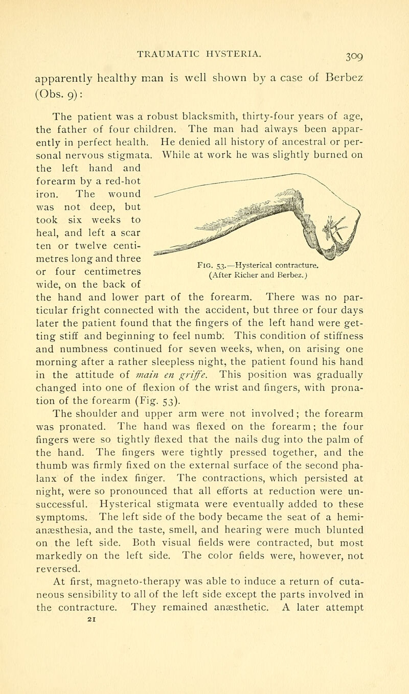 Fig. 53.—Hysterical contracture. (After Richer and Berbez.) apparently healthy man is well shown by a case of Berbez (Obs. 9): The patient was a robust blacksmith, thirty-four years of age, the father of four children. The man had always been appar- ently in perfect health. He denied all history of ancestral or per- sonal nervous stigmata. While at work he was slightly burned on the left hand and forearm by a red-hot iron. The wound was not deep, but took six weeks to heal, and left a scar ten or twelve centi- metres long and three or four centimetres wide, on the back of the hand and lower part of the forearm. There was no par- ticular fright connected with the accident, but three or four days later the patient found that the fingers of the left hand were get- ting stiff and beginning to feel numb: This condition of stiffness and numbness continued for seven weeks, when, on arising one morning after a rather sleepless night, the patient found his hand in the attitude of Diain en griffe. This position was gradually changed into one of flexion of the wrist and fingers, with prona- tion of the forearm (Fig. 53). The shoulder and upper arm were not involved ; the forearm was pronated. The hand was flexed on the forearm; the four fingers were so tightly flexed that the nails dug into the palm of the hand. The fingers were tightly pressed together, and the thumb was firmly fixed on the external surface of the second pha- lanx of the index finger. The contractions, which persisted at night, were so pronounced that all efforts at reduction were un- successful. Hysterical stigmata were eventually added to these symptoms. The left side of the body became the seat of a hemi- anjesthesia, and the taste, smell, and hearing were much blunted on the left side. Both visual fields were contracted, but most markedly on the left side. The color fields were, however, not reversed. At first, magneto-therapy was able to induce a return of cuta- neous sensibility to all of the left side except the parts involved in the contracture. They remained anaesthetic. A later attempt