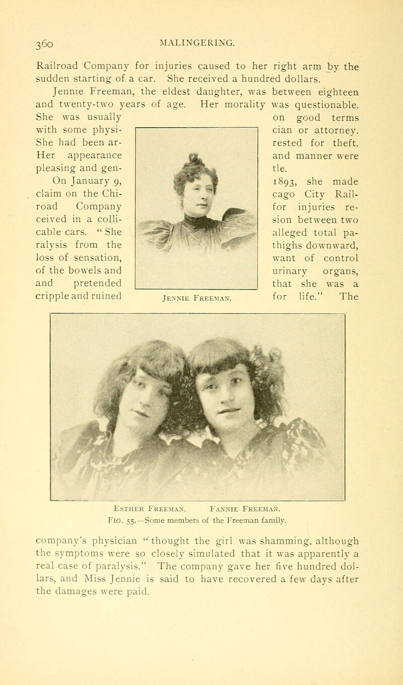Railroad Company for injuries caused to her right arm by the sudden starting of a car. She received a hundred dollars. Jennie Freeman, the eldest daughter, was between eighteen and twenty-two years of age. Her morality was questionable. She was usually with some physi- She had been ar- Her appearance pleasing and gen- On January 9, claim on the Chi- road Company ceived in a colli- cable cars. She ralysis from the loss of sensation, of the bowels and and pretended cripple and ruined Jexnie Freeman. on good terms cian or attorney, rested for theft, and manner were tie. 1S93, she made cago City Rail- for injuries re- sion between two alleged total pa- thighs downward, want of control urinary organs, that she was a for life. The Esther Freem.^n. Fannie Freeman. Fig. 55.—Some members of the Freeman family. company's physician ^ thought the girl was shamming, although the symptoms were so closely simulated that it was apparently a real case of paralysis. The company gave her five hundred dol- lars, and Miss Jennie is said to have recovered a few days after the damages were paid.