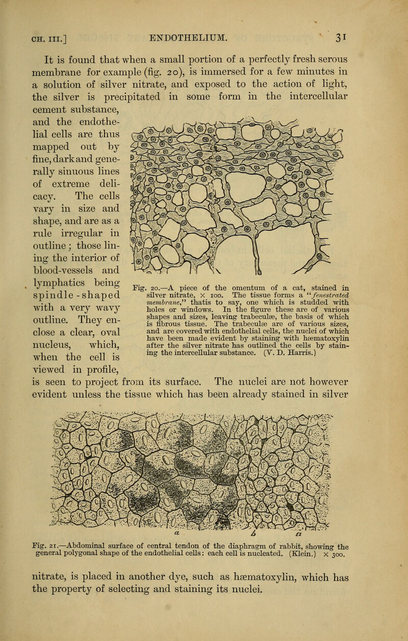 It is found that when a small portion of a perfectly fresh serous membrane for example (fig. 20), is immersed for a few minutes in a solution of silver nitrate, and exposed to the action of light, the silver is precipitated in some form in the intercellular cement substance, and the endothe- lial cells are thus mapped out by fine, dark and gene- rally sinuous lines of extreme deli- cacy. The cells vary in size and shape, and are as a rule irregular in outline; those lin- ing the interior of blood-vessels and lymphatics being spindle -shaped with a very wavy outline. They en- close a clear, oval nucleus, which, when the cell is viewed in profile, is seen to project from its surface. The nuclei are not however evident unless the tissue which has been already stained in silver Fig. 20.—A piece of the omentum of a cat, stained in silver nitrate, X ioo. The tissue forms a fenestrated membrane, thatis to say, one which is studded with holes or windows. In the figure these are of various shapes and sizes, leaving trabeculee, the basis of which is fibrous tissue. The trabeculee are of various sizes, and are covered with endothelial cells, the nuclei of which have been made evident by staining with heematoxylin after the silver nitrate has outlined the cells by stain- ing the intercellular substance. (V. D. Harris.) Fig. 21.—Abdominal surface of central tendon of the diaphragm of rabbit, showing the general polygonal shape of the endothelial cells: each cell is nucleated. (Klein.) x 300. nitrate, is placed in another dye, such as hematoxylin, which has the property of selecting and staining its nuclei.