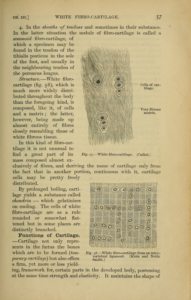 Cells of car- tilage. Yery fibrous matrix. 4. In the sheaths of tendons and sometimes in their substance. In the latter situation the nodule of fibro-cartilage is called a sesamoid fibro-cartilage, of which a specimen may be found in the tendon of the tibialis posticus in the sole of the foot, and usually in the neighbouring tendon of the peroneus longus. Structure,—White fibro- cartilage (fig. 58), which is much more widely distri- buted throughout the body than the foregoing kind, is composed, like it, of cells and a matrix; the latter, however, being made up almost entirely of fibres closely resembling those of white fibrous tissue. In this kind of fibro-car- tilage it is not unusual to find a great part of its mass composed almost ex- clusively of fibres, and deriving the name of cartilage only from the fact that in another portion, continuous with it, cartilage cells may be pretty freely distributed. By prolonged boiling, carti- lage yields a substance called chondrin — which gelatinizes on cooling. The cells of white fibro-cartilage are as a rule rounded or somewhat flat- tened but in some places are distinctly branched. Functions of Cartilage. —Cartilage not only repre- sents in the foetus the bones which are to be formed (tem- porary cartilage) but also offers a firm, yet more or less yield- ing, framework for, certain parts in the developed body, possessing at the same time strength and elasticity. It maintains the shape of Fig. 57.—White fibro-cartilage. (Cadiat. Fig. 58.—Wbite fibro-cartilage from an inter- vertebral ligament. (Klein and Noble Smith.)