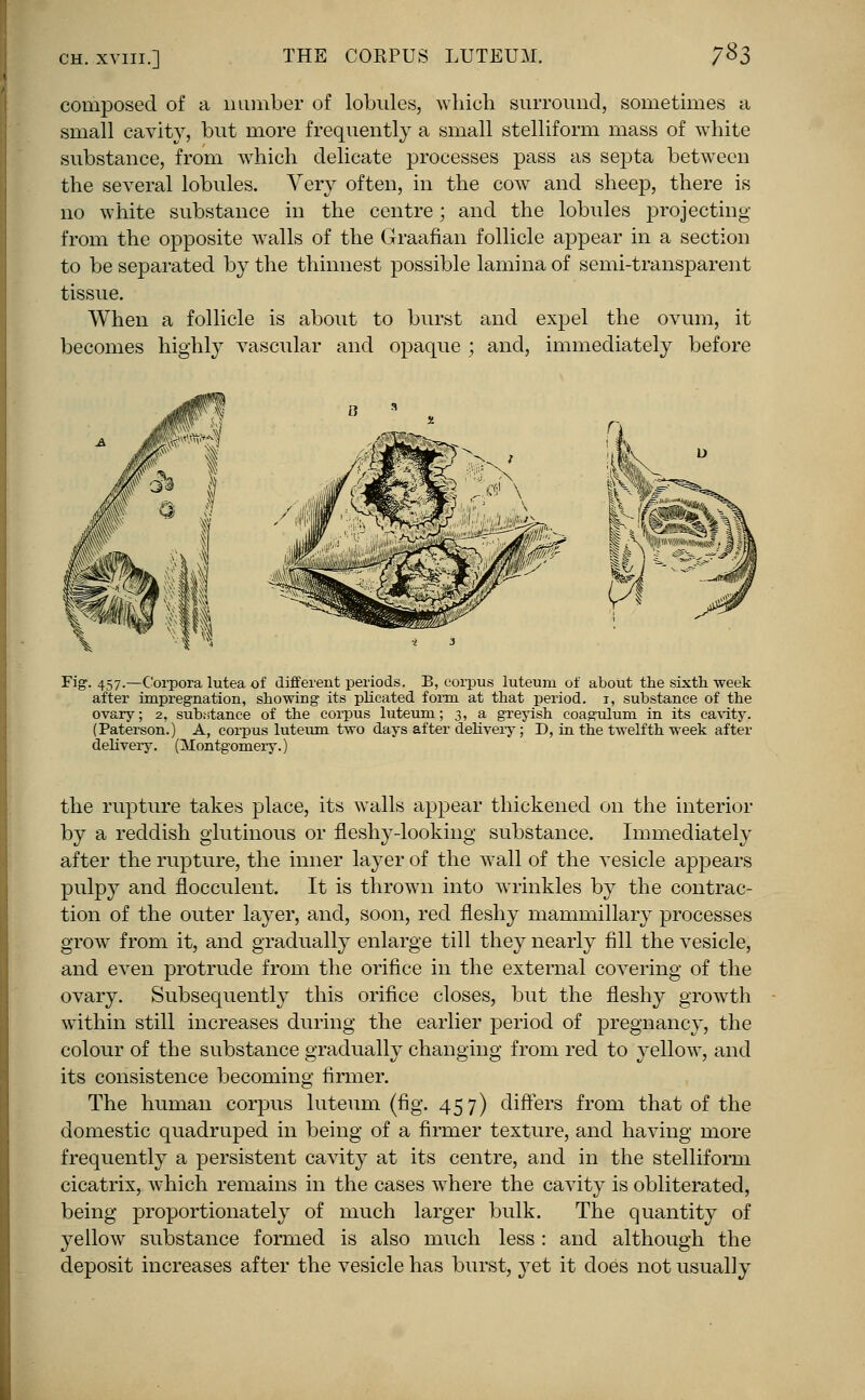 7*3 composed of a number of lobules, which surround, sometimes a small cavity, but more frequently a small stelliform mass of white substance, from which delicate processes pass as septa between the several lobules. Very often, in the cow and sheep, there is no white substance in the centre; and the lobules projecting from the opposite walls of the Graafian follicle appear in a section to be separated by the thinnest possible lamina of semi-transparent tissue. When a follicle is about to burst and expel the ovum, it becomes highly vascular and opaque ; and, immediately before Fig. 457.—Corpora lutea of different periods. B, corpus luteum of about the sixth week after impregnation, showing its plicated form at that period. 1, substance of the ovary; 2, suhstanee of the corpus luteum; 3, a greyish coagulum in its cavity. (Paterson.) A, corpus luteum two days after delivery; D, in the twelfth week after delivery. (Montgomery.) the rupture takes place, its walls appear thickened on the interior by a reddish glutinous or fleshy-looking substance. Immediately after the rupture, the inner layer of the wall of the vesicle appears pulpy and flocculent. It is thrown into wrinkles by the contrac- tion of the outer layer, and, soon, red fleshy mammillary processes grow from it, and gradually enlarge till they nearly fill the vesicle, and even protrude from the orifice in the external covering of the ovary. Subsequently this orifice closes, but the fleshy growth within still increases during the earlier period of pregnancy, the colour of the substance gradually changing from red to yellow, and its consistence becoming firmer. The human corpus luteum (fig. 457) differs from that of the domestic quadruped in being of a firmer texture, and having more frequently a persistent cavity at its centre, and in the stelliform cicatrix, which remains in the cases where the cavity is obliterated, being proportionately of much larger bulk. The quantity of yellow substance formed is also much less : and although the deposit increases after the vesicle has burst, }Tet it does not usually