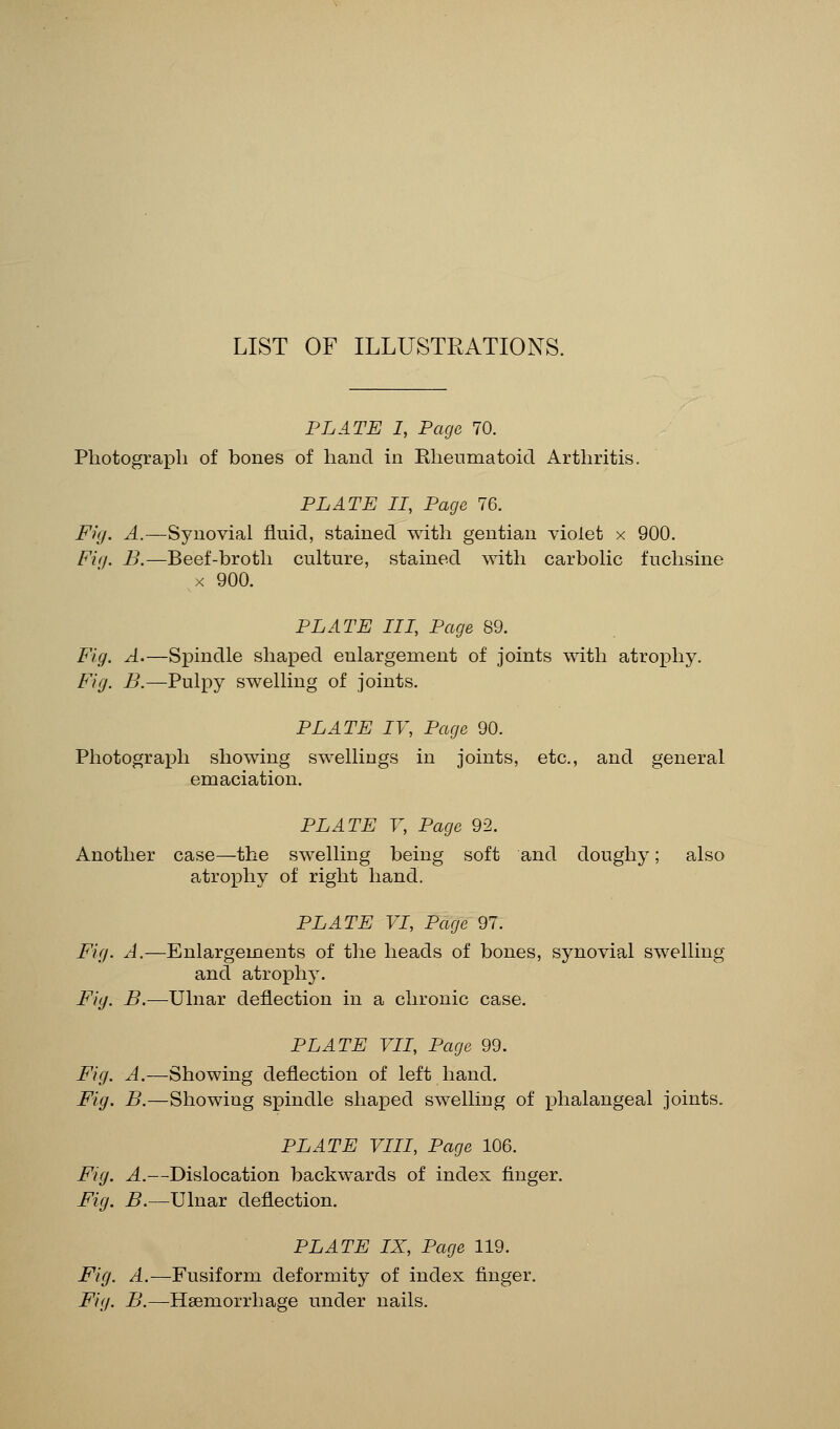 LIST OF ILLUSTRATIONS. PLATE I, Page 70. Photograph of bones of hand in Rheumatoid Arthritis. PLATE II, Page 76. Fig. A.—Synovial fluid, stained with gentian violet x 900. Fig. B.— Beef-broth culture, stained with carbolic fuchsine x 900. PLATE III, Page 89. Fig. A.—Spindle shaped enlargement of joints with atrophy. Fig. B.—Pulpy swelling of joints. PLATE IV, Page 90. Photograph showing swellings in joints, etc., and general emaciation. PLATE V, Page 92. Another case—the swelling being soft and doughy; also atrophy of right hand. PLATE VI, Page 97. Fig. A.—Enlargements of the heads of bones, synovial swelling and atrophy. Fig. B.—Ulnar deflection in a chronic case. PLATE VII, Page 99. Fig. A.—Showing deflection of left hand. Fig. B.—Showing spindle shaped swelling of phalangeal joints. PLATE VIII, Page 106. Fig. A.—Dislocation backwards of index finger. Fig. B.—Ulnar deflection. PLATE IX, Page 119. Fig. A.—Fusiform deformity of index finger. Fig. B.—Haemorrhage under nails.