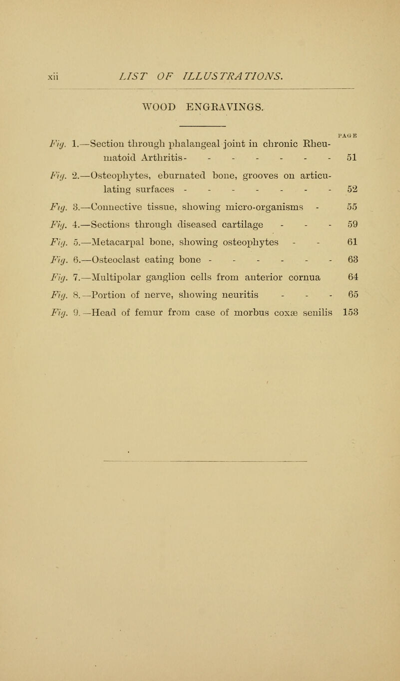 WOOD ENGRAVINGS. Fig. 1.—Section through phalangeal joint in chronic Rheu- matoid Arthritis- - - - - - 51 Fig. 2.—Osteophytes, eburnated bone, grooves on articu- lating surfaces ------- 52 Fig. 3.—Connective tissue, showing micro-organisms - 55 Fitj. 4.—Sections through diseased cartilage - - - 59 Fig. 5.—Metacarpal bone, showing osteophytes - - 61 Fig. 6.—Osteoclast eating bone ------ 63 Fig. 7.—Multipolar ganglion cells from anterior cornua 64 Fig. 8. —Portion of nerve, showing neuritis 65 Fig. 9. —Head of femur from case of morbus coxas senilis 153