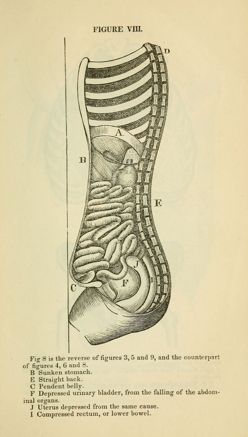 Fio- 8 is the reverse of figures 3, 5 and 9, and the counterpart of figures 4, 6 and 8. B Sunken stomach. E Straight back. C Pendent belly. F Depressed urinary bladder, from the falling of the abdom- inal organs. J Uterus depressed from the same cause. I Compressed rectum, or lower bowel.