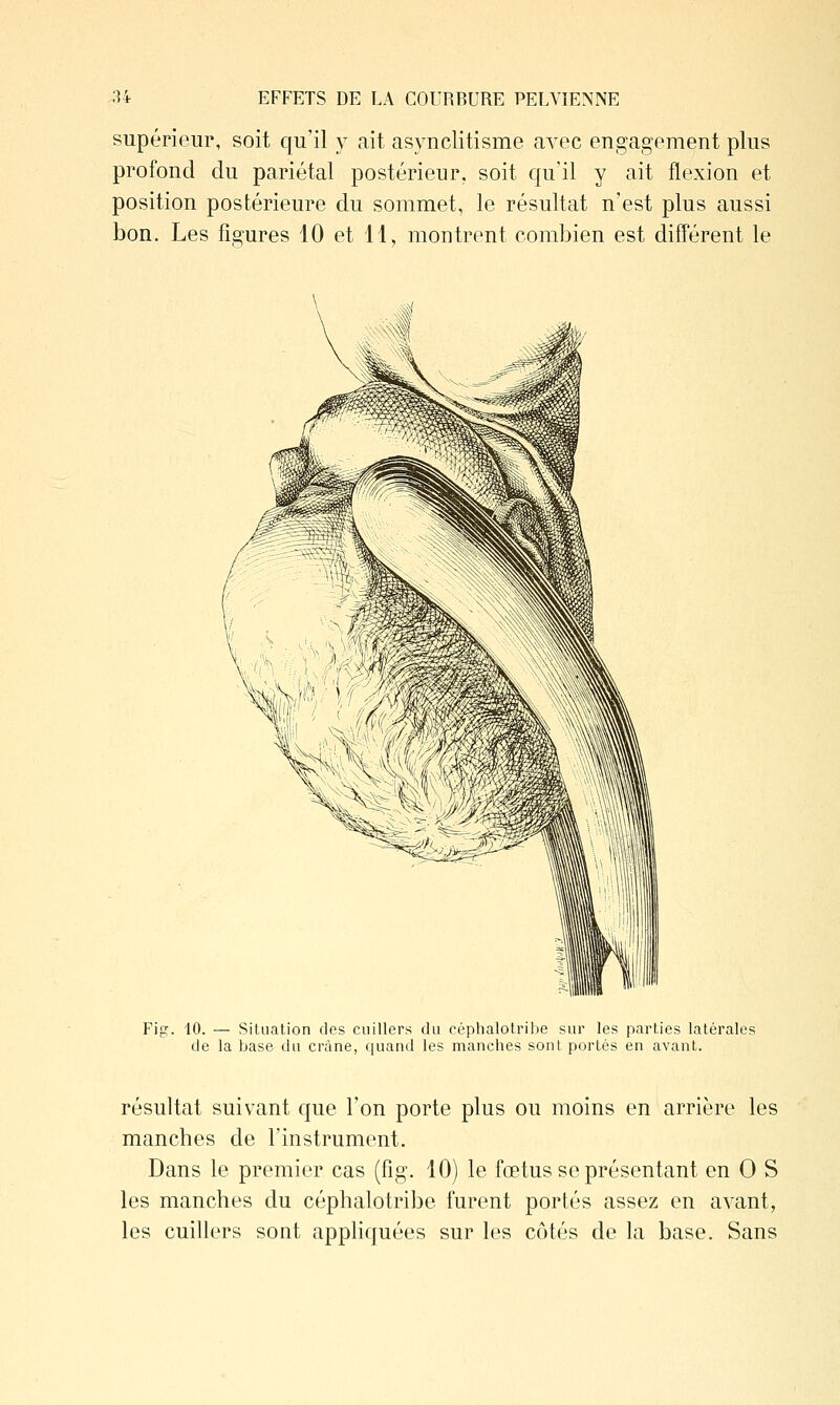 supérieur, soit qu'il y ait asynclitisme avec engagement plus profond du pariétal postérieur, soit qu'il y ait flexion et position postérieure du sommet, le résultat n'est plus aussi bon. Les figures 10 et 11, montrent combien est différent le Fig'. 10. — Situation des cuillers du céphalotribe sur les parties latérales de la base du crâne, quand les manches sont portés en avant. résultat suivant que l'on porte plus ou moins en arrière les manches de l'instrument. Dans le premier cas (fig. 10) le fœtus se présentant en 0 S les manches du céphalotribe furent portés assez en avant, les cuillers sont appliquées sur les côtés de la base. Sans