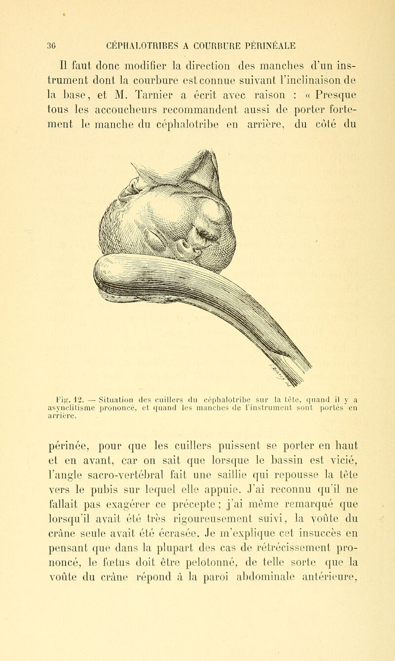 Il faut donc modifier la direction des manches d'un ins- trument dont la courbure est connue suivant l'inclinaison de la base, et M. Tarnier a écrit avec raison : « Presque tous les accoucheurs recommandent aussi de porter forte- ment le manche du céphalotribe en arrière, du côlé du Fig. i2. — Situation des cuillers du céphalotribe sur la tête, quand il y a asynclitisme prononcé, et quand les manches de l'instrument sont portés en arrière. périnée, pour que les cuillers puissent se porter en haut et en avant, car on sait que lorsque le bassin est vicié, l'angle sacro-vertébral fait une saillie cjui repousse la tête vers le pubis sur lequel elle appuie. J'ai reconnu qu'il ne fallait pas exagérer ce précepte; j'ai même remarqué que lorsqu'il avait été très rigoureusement suivi, la voûte du crâne seule avait été écrasée. Je m'explique cet insuccès en pensant que dans la plupart des cas de rétrécissement pro- noncé, le fœtus doit être pelotonné, de telle sorte que la voûte du crâne répond à la paroi abdominale antérieure,