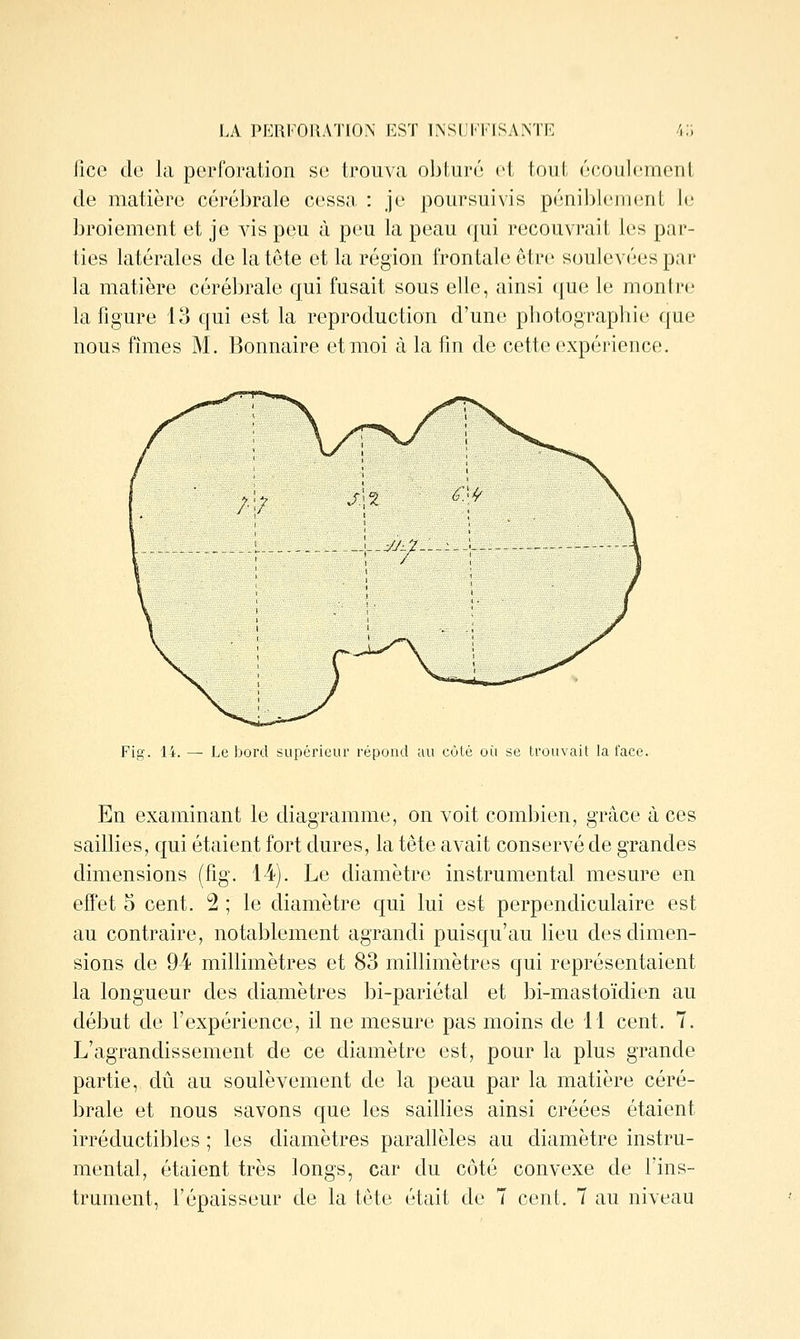 LA PERFORATION EST INSUFFISANTE 4;; iico de la perforation se; trouva obturé l't toul, (M'ouicmeiil de matière cérébrale cessîi : je poursuivis péniljiejrK^nL le broiement et je vis peu à peu la peau qui recouvrait les par- ties latérales de la tête et la région frontale être soulevées par la matière cérébrale qui fusait sous elle, ainsi (jue le montre la figure 13 qui est la reproduction d'une photographie que nous fîmes M. Bonnaire et moi à la fin de cette expérience. Fig. 14. — Le bord supérieur répond au côlé où se trouvait la face. En examinant le diagramme, on voit combien, grâce à ces saillies, qui étaient fort dures, la tête avait conservé de grandes dimensions (fig. 14). Le diamètre instrumental mesure en effet 5 cent. 2 ; le diamètre qui lui est perpendiculaire est au contraire, notablement agrandi puisqu'au lieu des dimen- sions de 94 millimètres et 83 millimètres qui représentaient la longueur des diamètres bi-pariétal et bi-mastoïdien au début de l'expérience, il ne mesure pas moins de 11 cent. 7. L'agrandissement de ce diamètre est, pour la plus grande partie, dû au soulèvement de la peau par la matière céré- brale et nous savons que les saillies ainsi créées étaient irréductibles ; les diamètres parallèles au diamètre instru- mental, étaient très longs, car du côté convexe de l'ins-