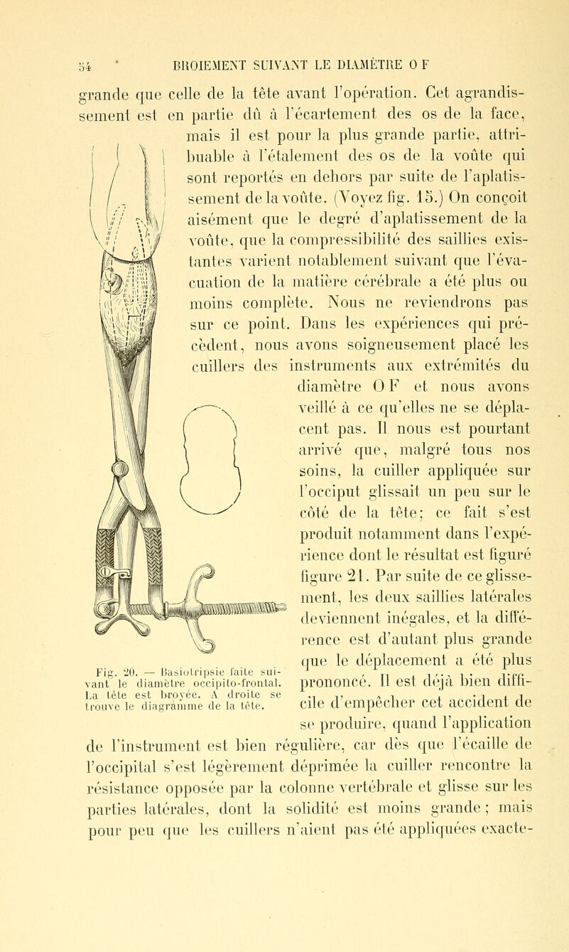 grande que celle de la tête avant l'opération. Cet agrandis- sement est en partie dû à l'écartement des os de la face, mais il est pour la plus grande partie, attri- buable à l'étalement des os de la voûte qui sont reportés en dehors par suite de l'aplatis- sement de la voûte. (Voyez fig. 15.) On conçoit aisément c[ue le degré d'aplatissement de la voûte, que la compressibilité des saillies exis- tantes varient notablement suivant que l'éva- cuation de la matière cérébrale a été plus ou moins complète. Nous ne reviendrons pas sur ce point. Dans les expériences qui pré- cèdent, nous avons soigneusement placé les cuillers des instruments aux extrémités du diamètre 0 F et nous avons veillé à ce qu'elles ne se dépla- cent pas. Il nous est pourtant arrivé que, malgré tous nos soins, la cuiller appliquée sur l'occiput glissait un peu sur le côté de la tête; ce fait s'est produit notamment dans l'expé- rience dont le résultat est figuré figure 21. Par suite de ce glisse- ment, les deux saillies latérales deviennent inégales, et la diffé- rence est d'autant plus grande que le déplacement a été plus prononcé. 11 est déjà bien diffi- cile d'empêcher cet accident de se produire, quand l'application de l'instrument est bien réguHère, car dès que l'écaillé de l'occipital s'est légèrement déprimée la cuiller rencontre la résistance opposée par la colonne vertébrale et glisse sur les parties latérales, dont la solidité est moins grande ; mais pour peu que les cuillers n'aient pas été appliquées exacte- Fig. 20. — DasiuLripsie l'aiLe sui- vant le diamèlre occipito-frontal. La tête est broyée. A droite se trouve le diagramme de la tête.