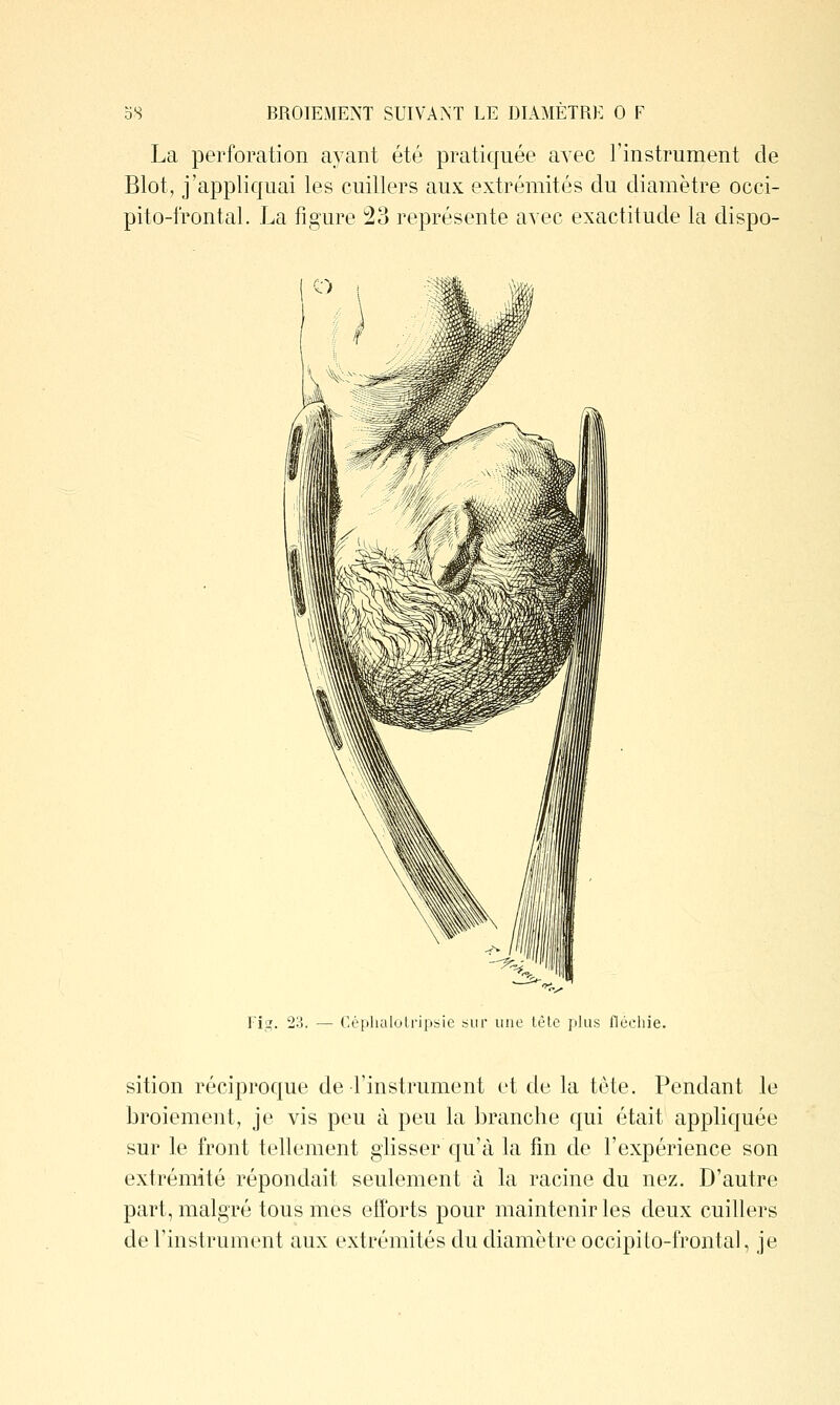 La perforation ayant été pratiquée avec l'instrument de Blot, j'appliquai les cuillers aux extrémités du diamètre occi- pito-frontal. La figure i23 représente avec exactitude la dispo- Fig. 2o. — ('èphalulripsie sur une têle plus flùchie. sition réciproque de l'instrument et de la tête. Pendant le broiement, je vis peu à peu la branche qui était appliquée sur le front tellement glisser qu'à la fin de l'expérience son extrémité répondait seulement à la racine du nez. D'autre part, malgré tous mes efforts pour maintenir les deux cuillers de l'instrument aux extrémités du diamètre occipito-frontal, je