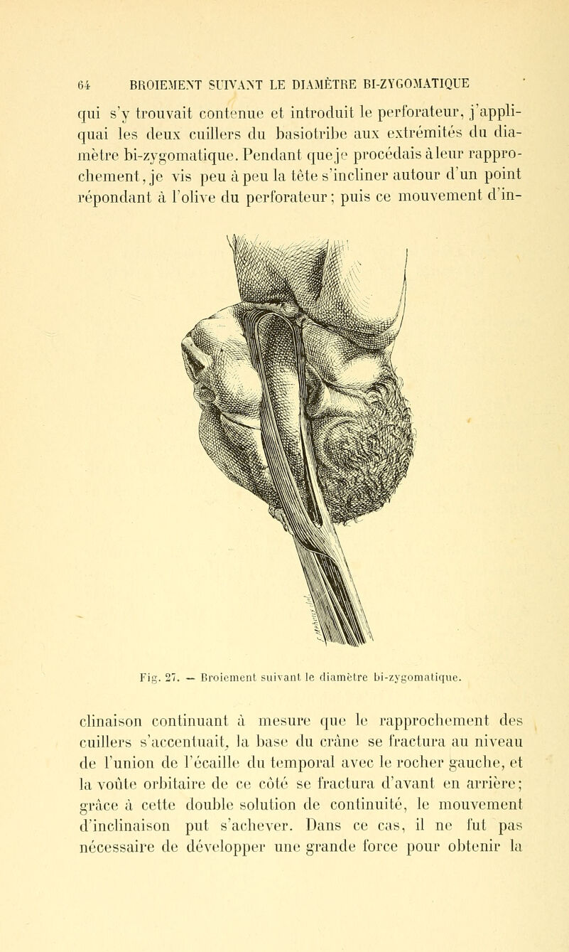 qui s'y trouvait contenue et introduit le perforateur, j'appli- quai les deux cuillers du basiotribe aux extrémités du dia- mètre bi-zygomatique. Pendant queje procédais à leur rappro- chement, je vis peu à peu la tête s'incliner autour d'un point répondant à l'olive du perforateur ; puis ce mouvement d'in- Fig. 27. — Broiement suivant le diamètre bi-zygomatique. clinaison continuant à mesure que le rapprochement des cuillers s'accentuait^ ]a base du crâne se fractura au niveau de l'union de l'écaillé du temporal avec le rocher gauche, et la voûte orbitaire de ce côté se fractura d'avant en arrière; grâce à cette double solution de continuité, le mouvement d'inclinaison put s'achever. Dans ce cas, il ne fut pas nécessaire de développer une grande force pour obtenir la